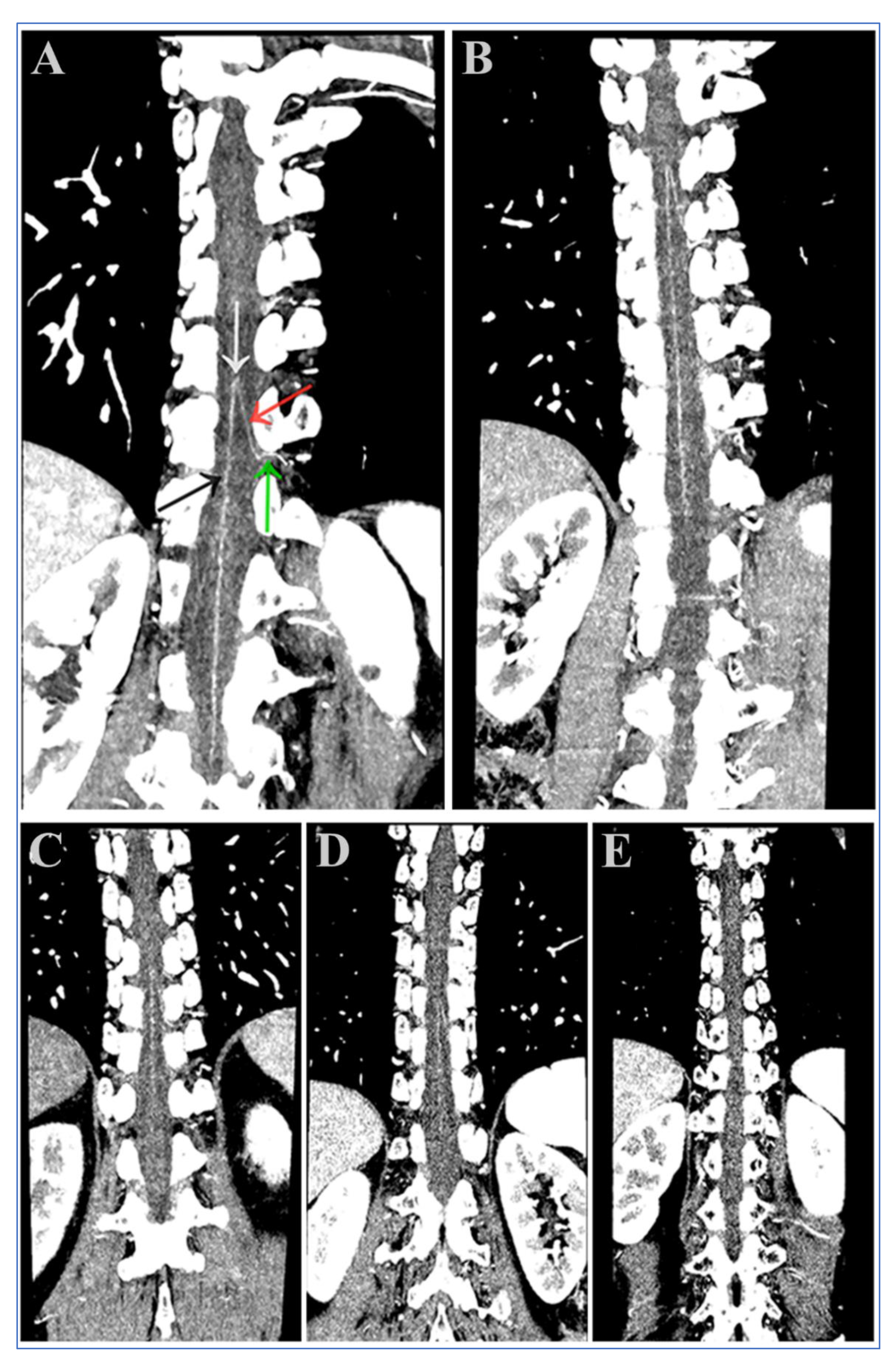 Diagnostics 13 02495 g002