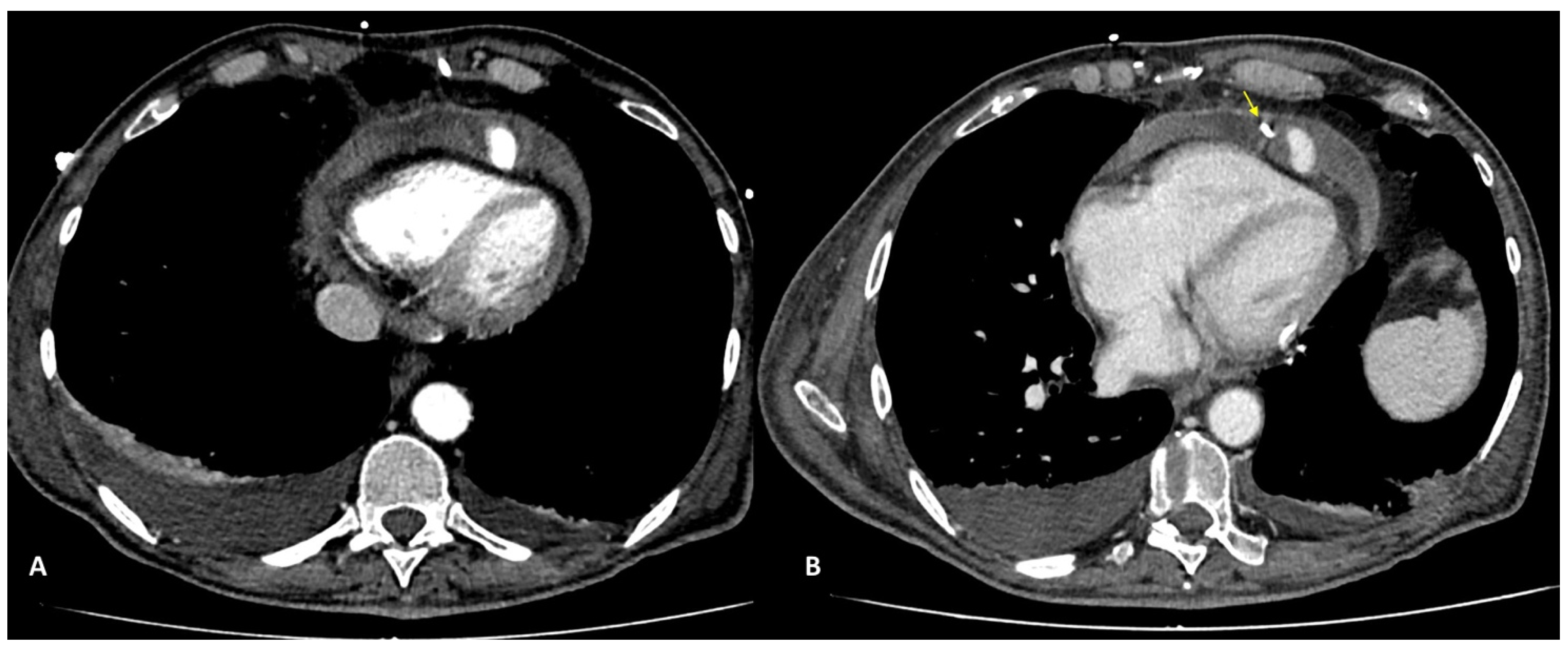 Diagnostics 13 02500 g004 Diagnostics 13 02500 g004