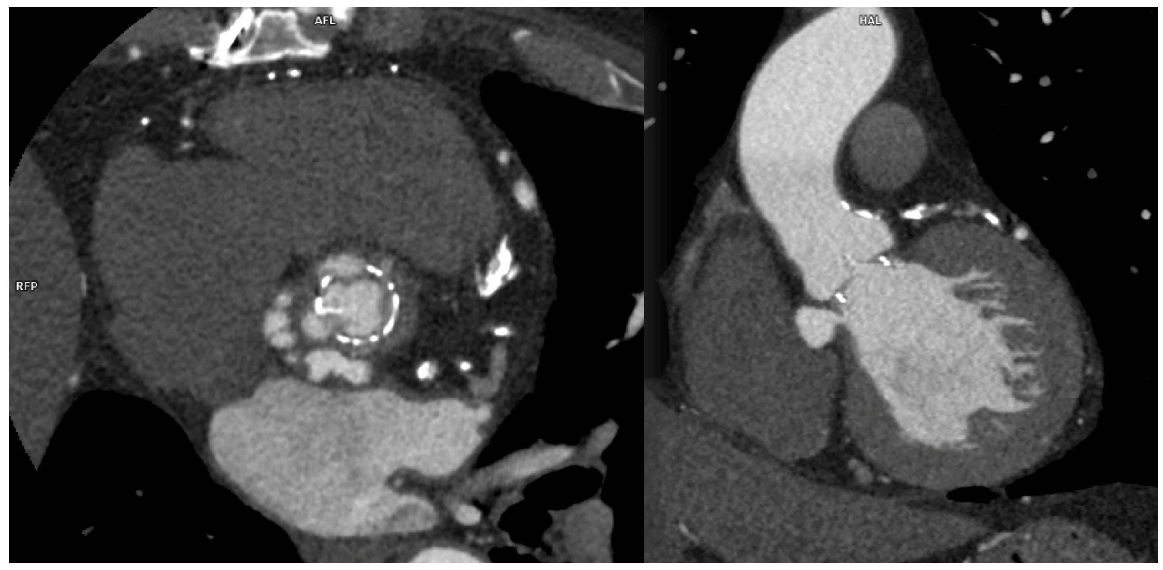 Diagnostics 13 02500 g005 Diagnostics 13 02500 g005