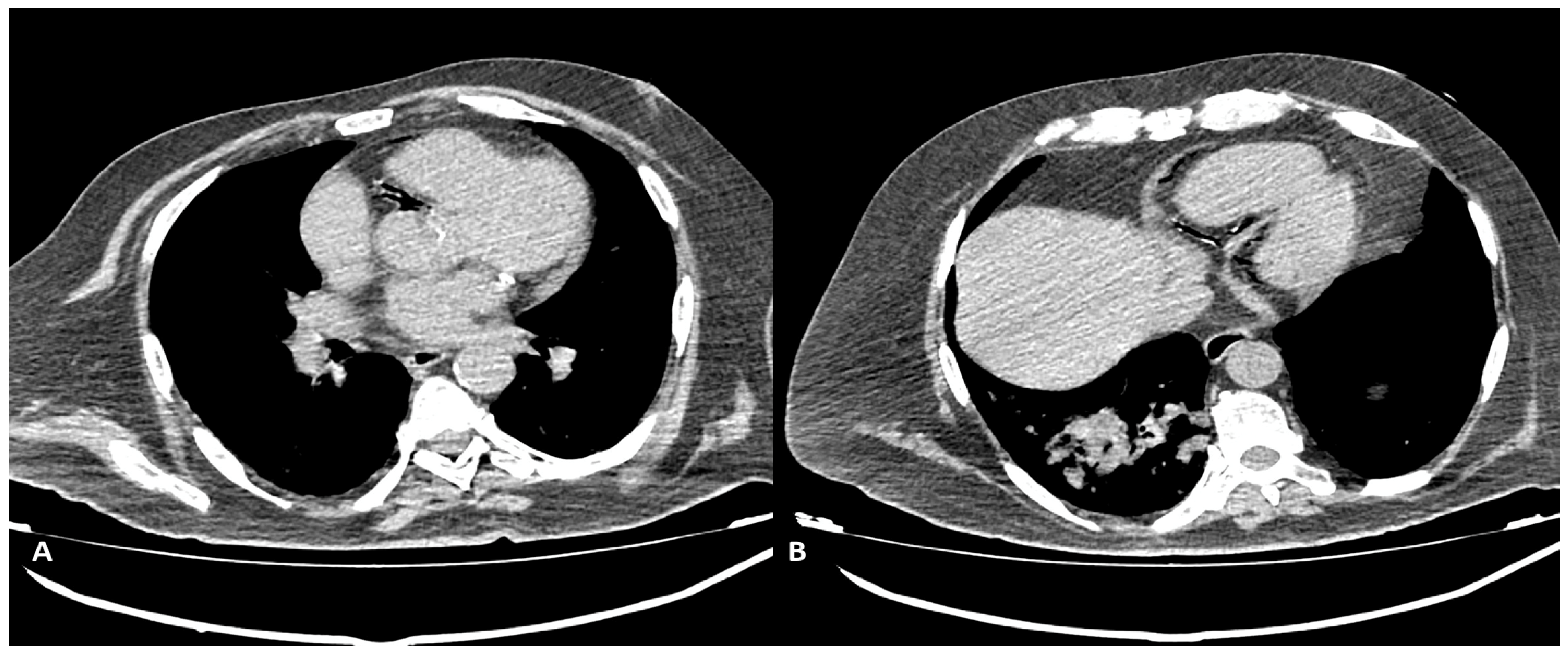 Diagnostics 13 02500 g007 Diagnostics 13 02500 g007