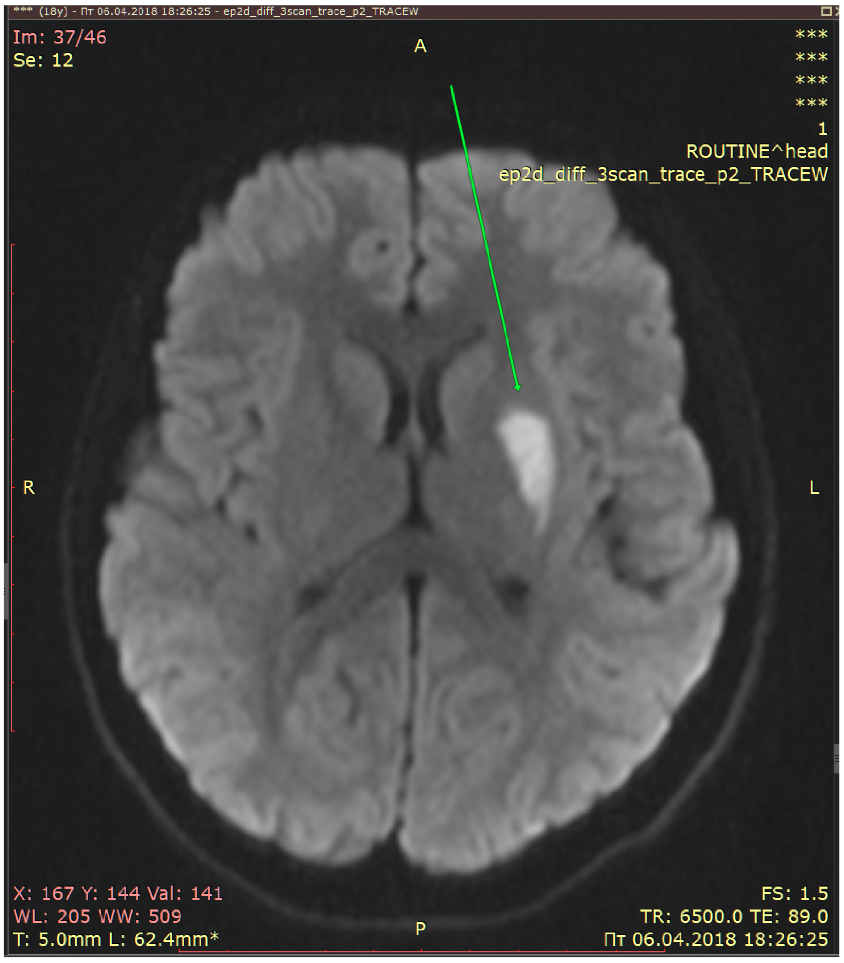 Diagnostics 13 02502 g002