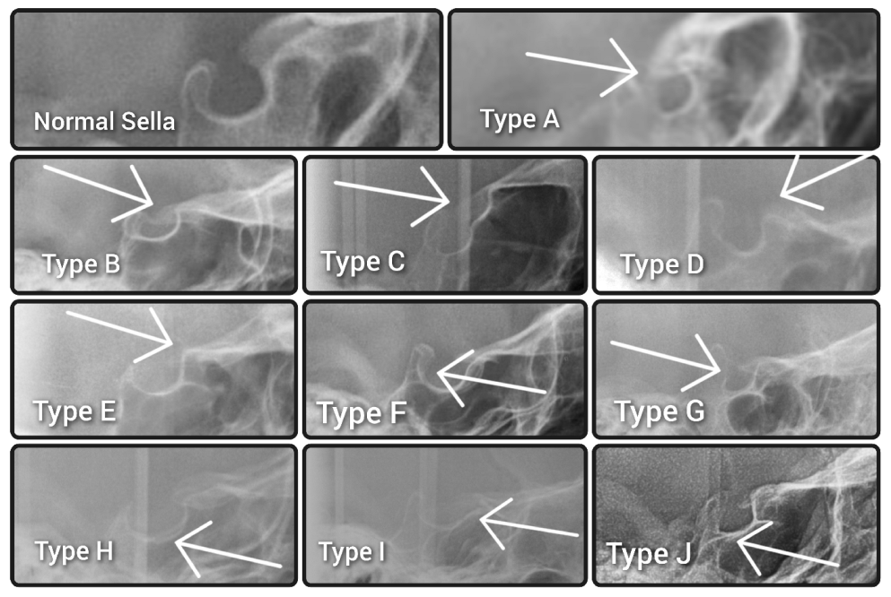 Diagnostics 13 02510 g001