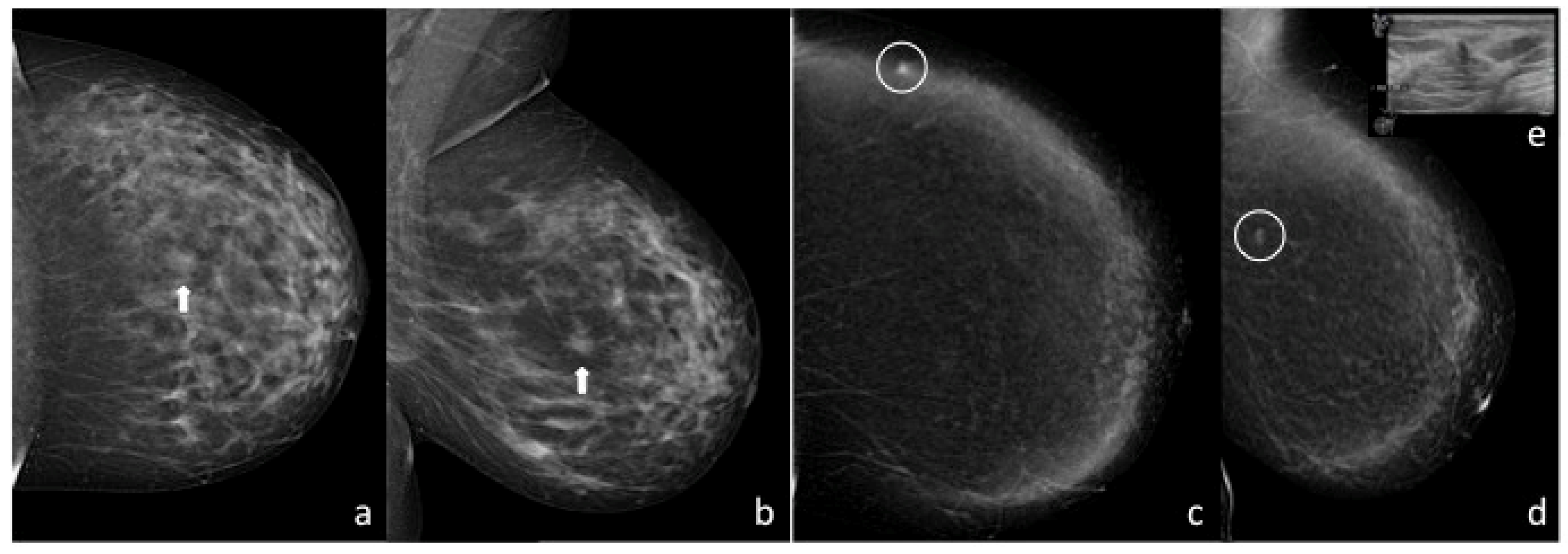 Diagnostics 13 02520 g004
