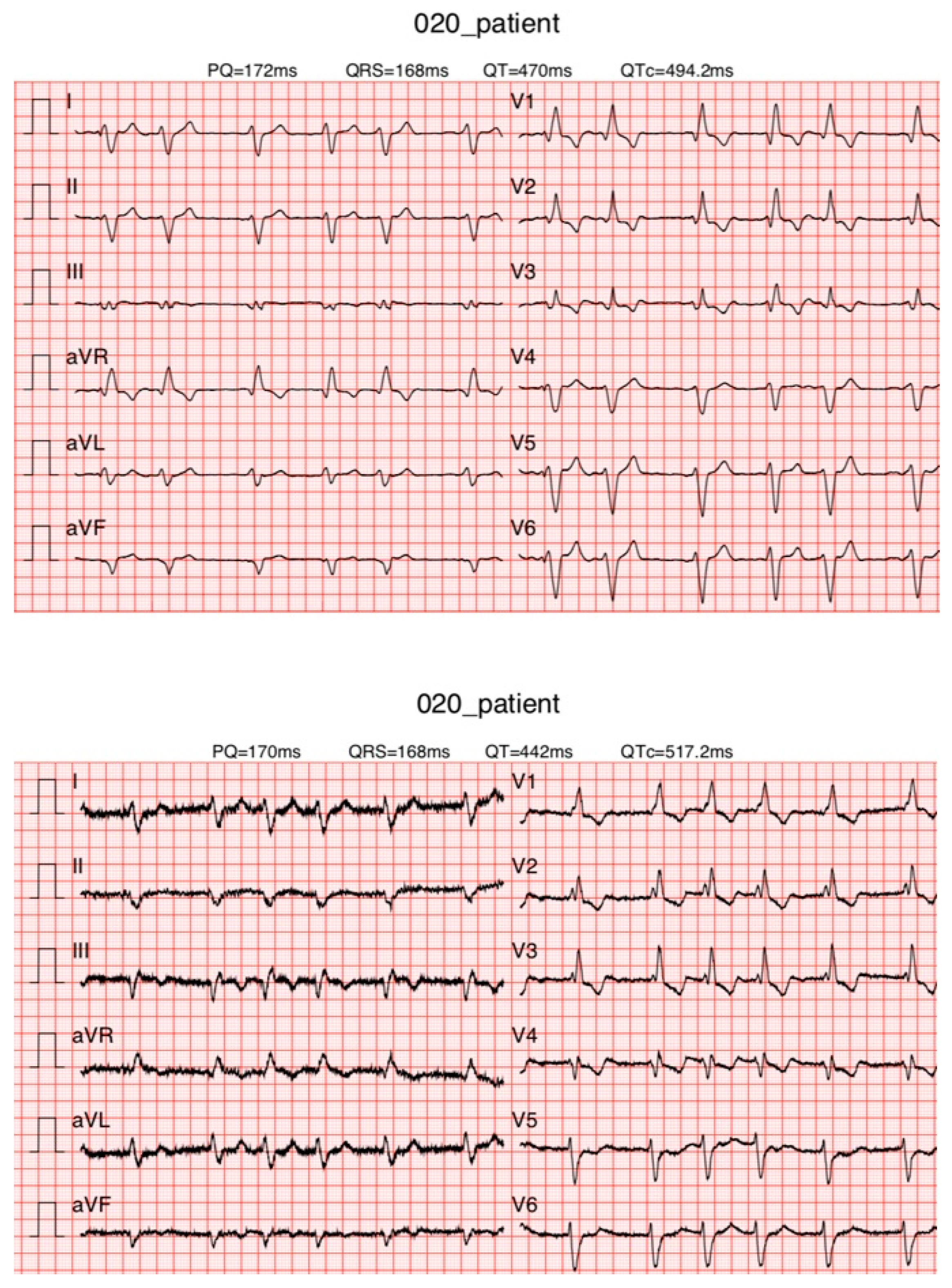 Diagnostics 13 02525 g008 Diagnostics 13 02525 g008
