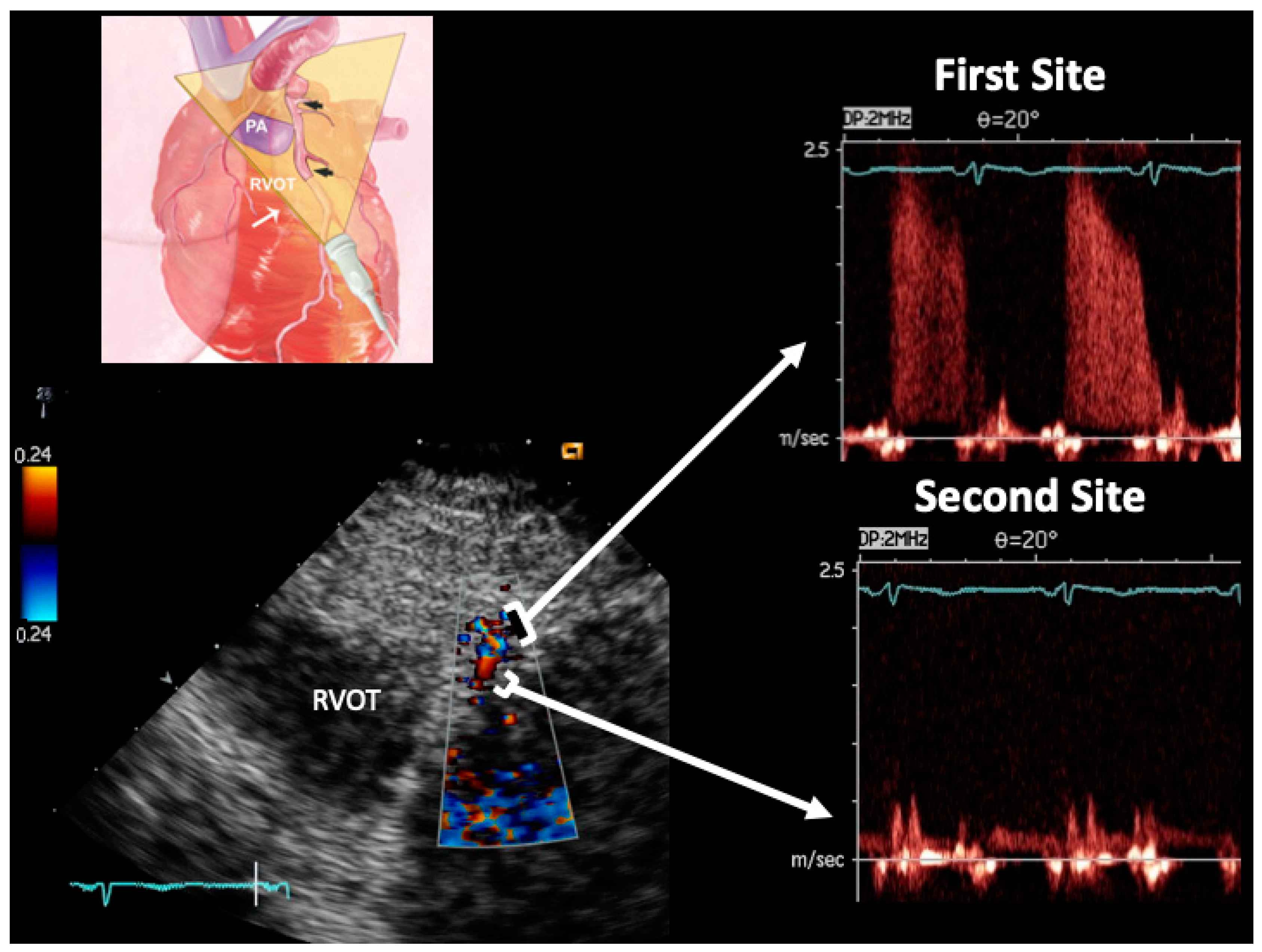 Diagnostics 13 02526 g002 Diagnostics 13 02526 g002