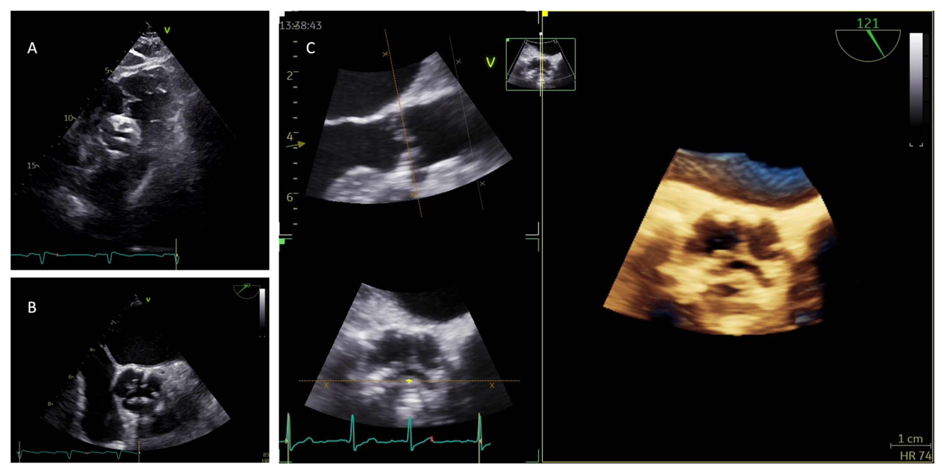 Diagnostics 13 02527 g004 Diagnostics 13 02527 g004