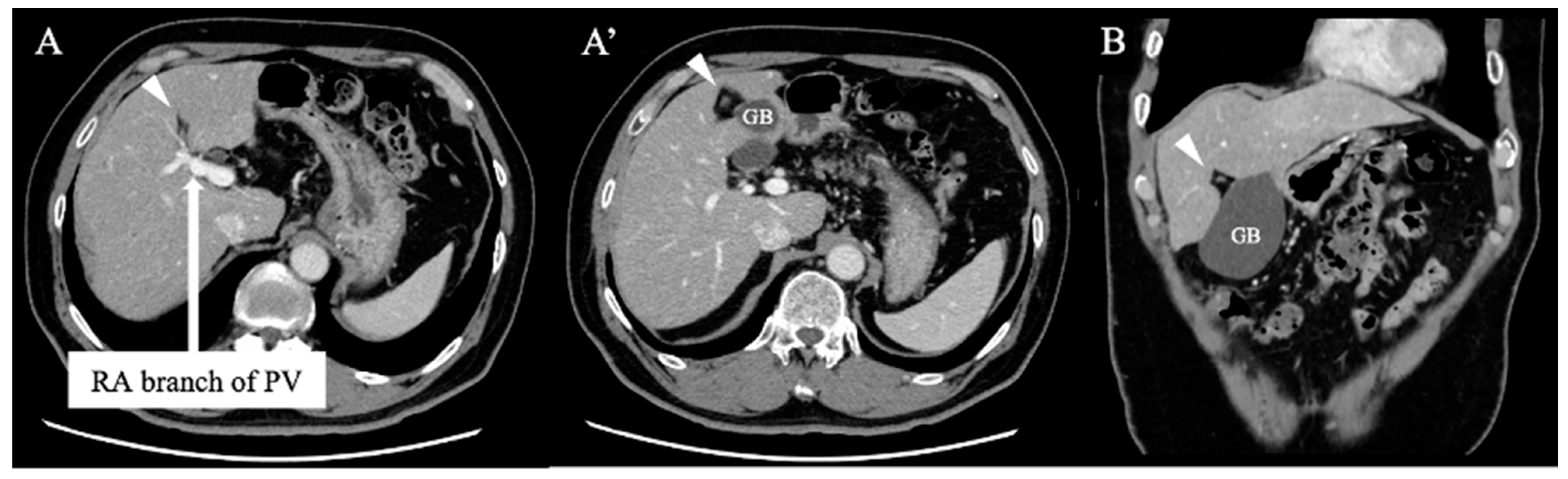 Diagnostics 13 02529 g002