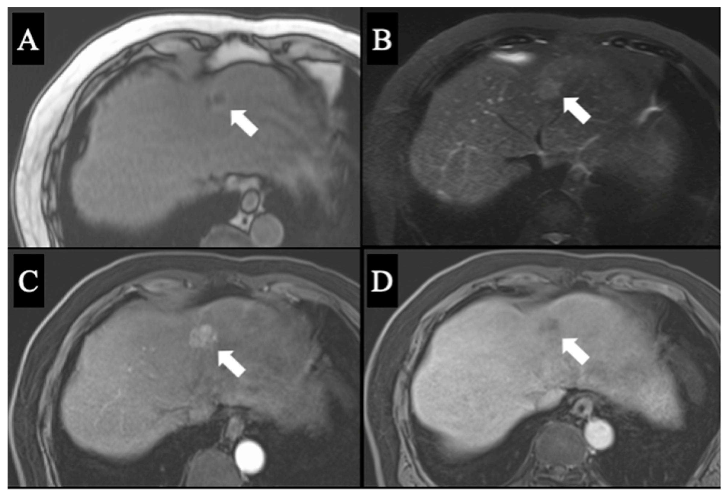 Diagnostics 13 02529 g003