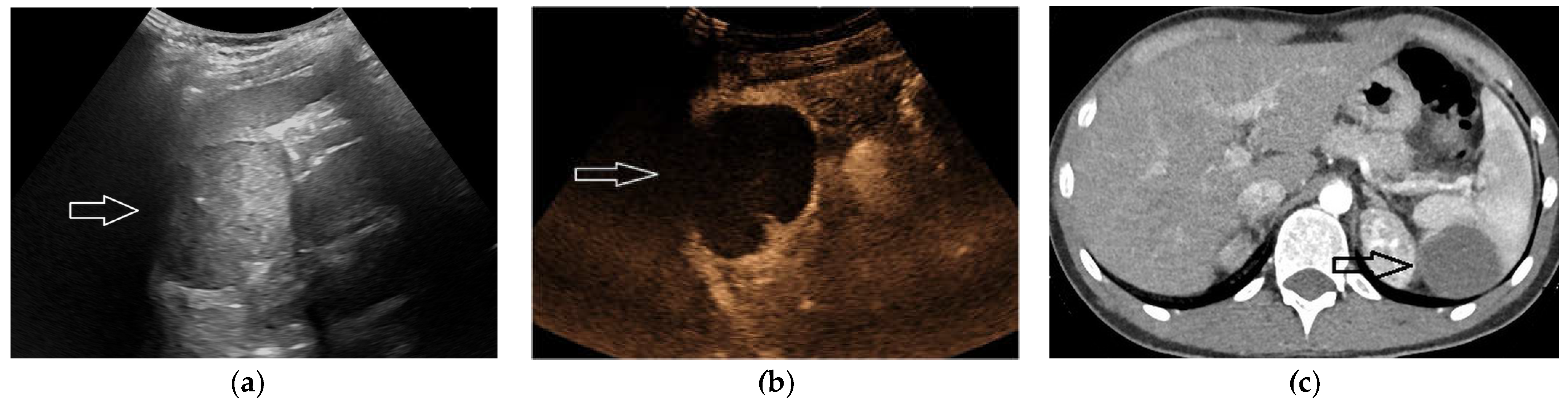 Diagnostics 13 02536 g003