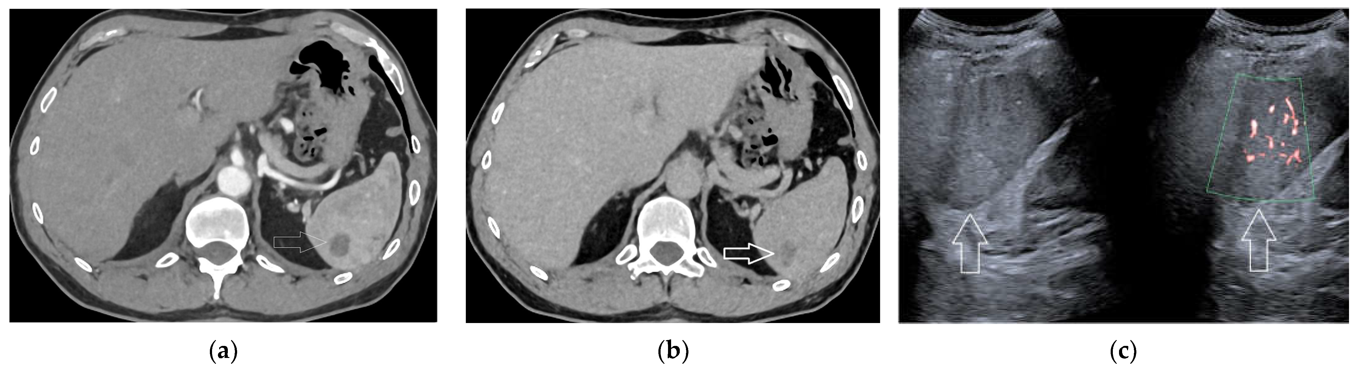 Diagnostics 13 02536 g004