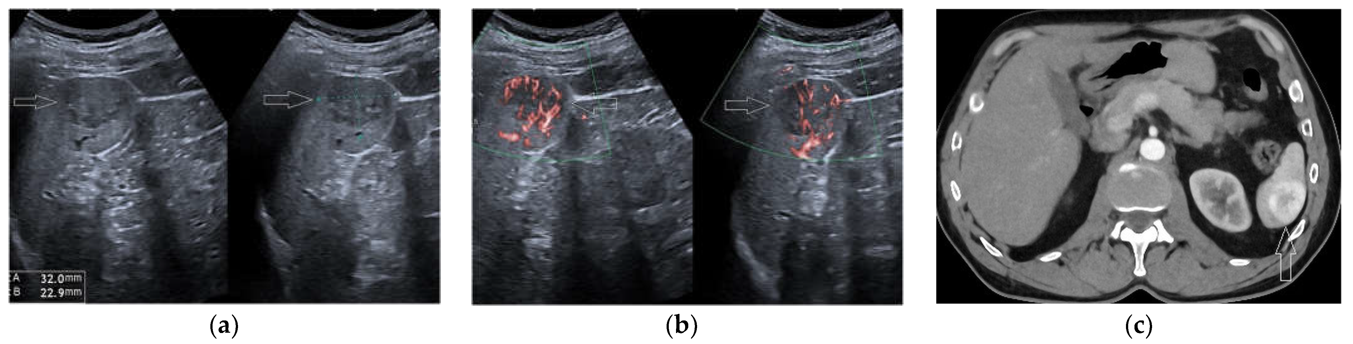 Diagnostics 13 02536 g005