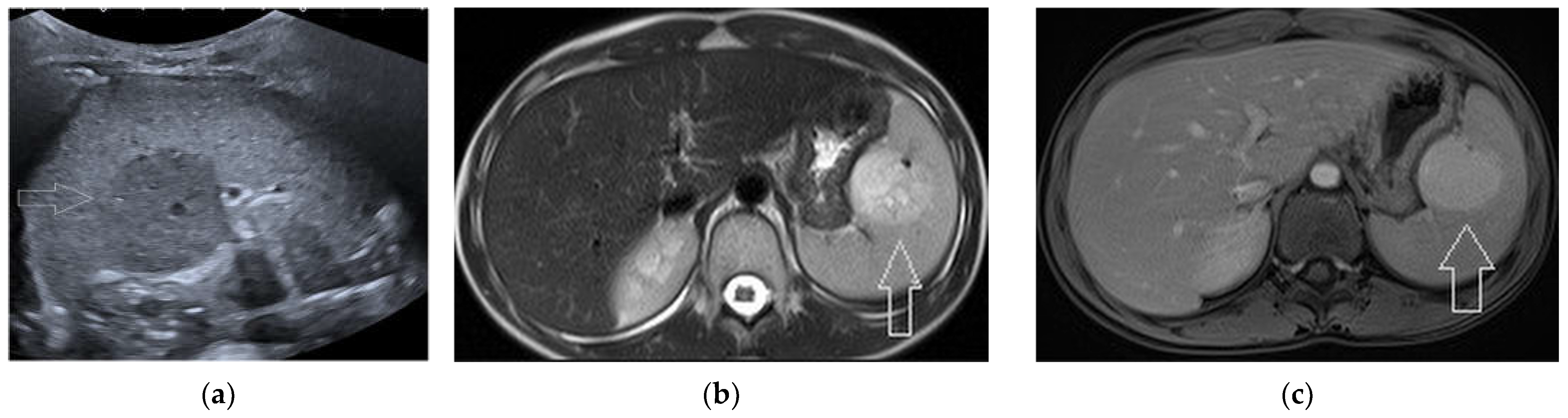Diagnostics 13 02536 g006