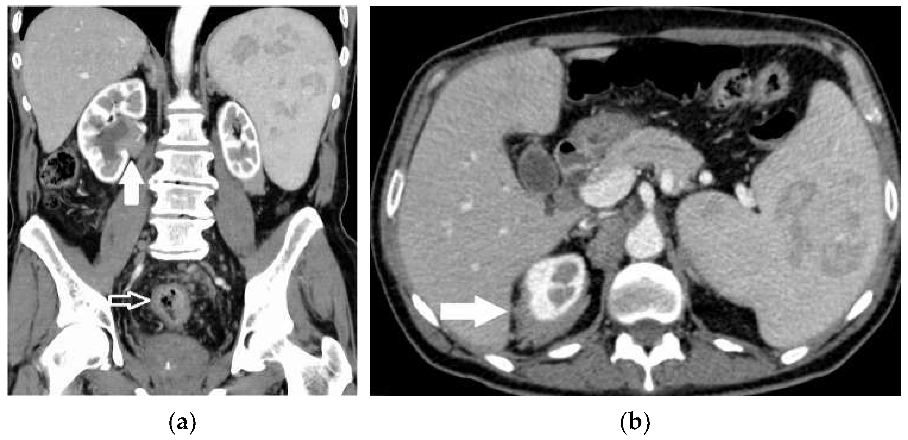 Diagnostics 13 02536 g007