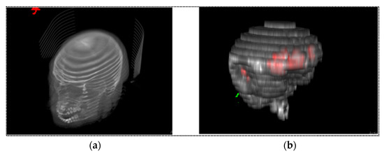 A Deep Learning-Based Automatic Segmentation and 3D Visualization