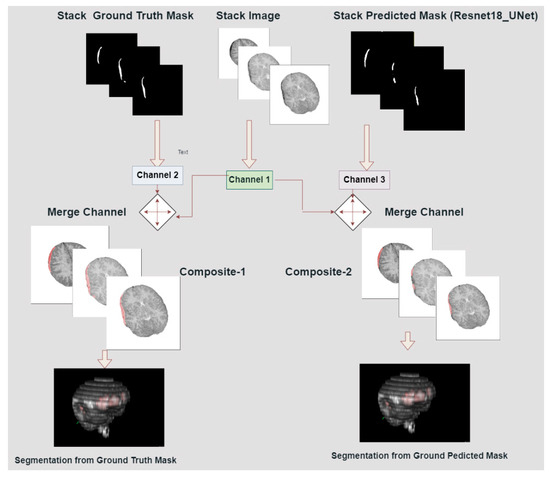 A Deep Learning-Based Automatic Segmentation and 3D Visualization