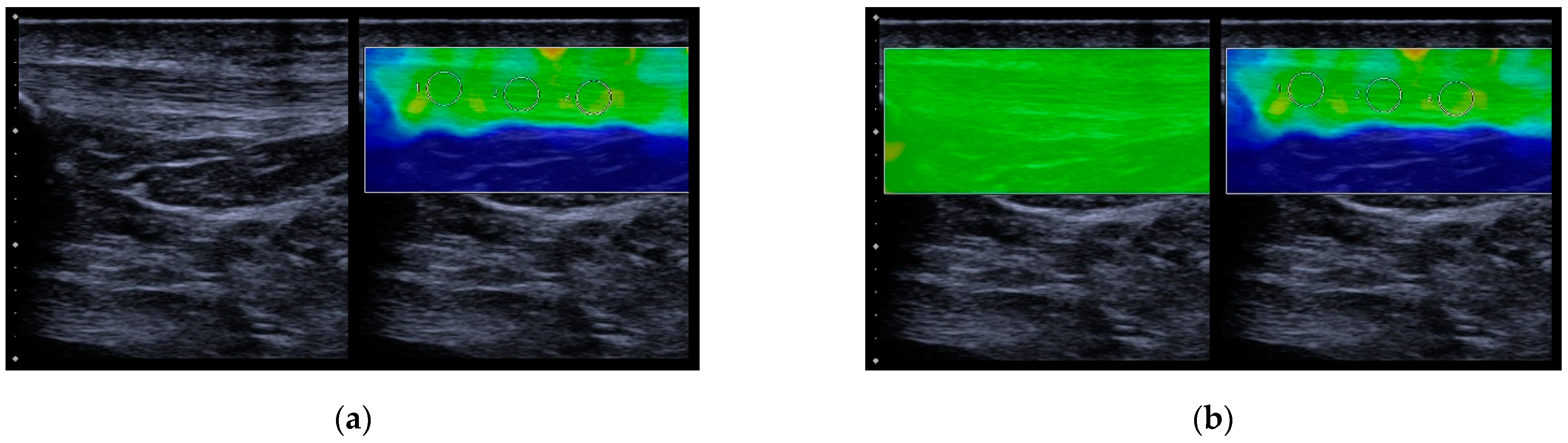 Diagnostics 13 02541 g002 Diagnostics 13 02541 g002
