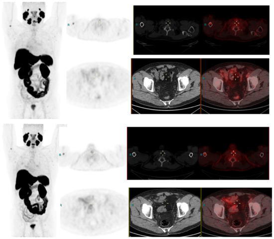 Diagnostics | Free Full-Text | Lessons from a 3-Year Review of PSMA PET ...
