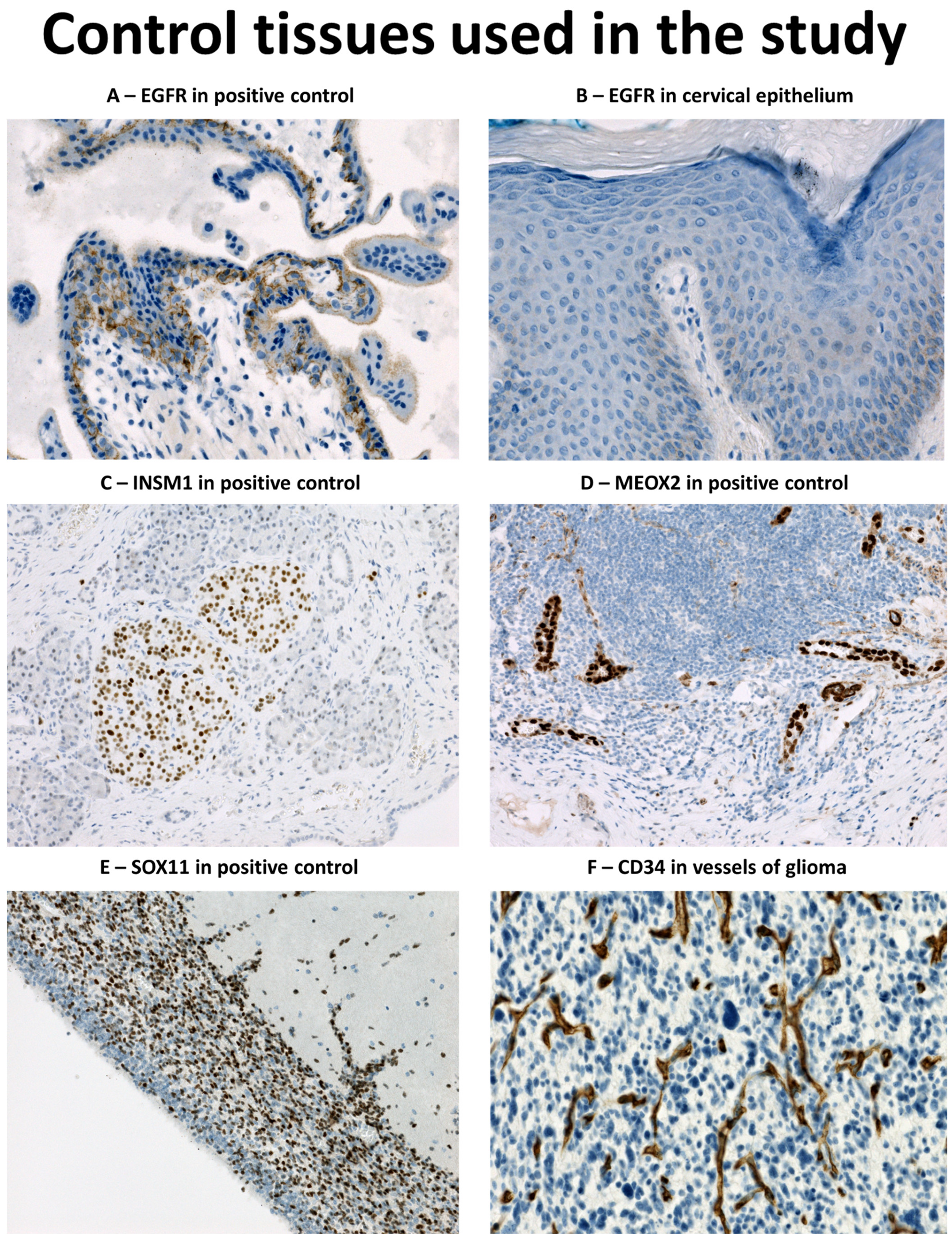 Diagnostic Immunohistochemistry | ScienceDirect