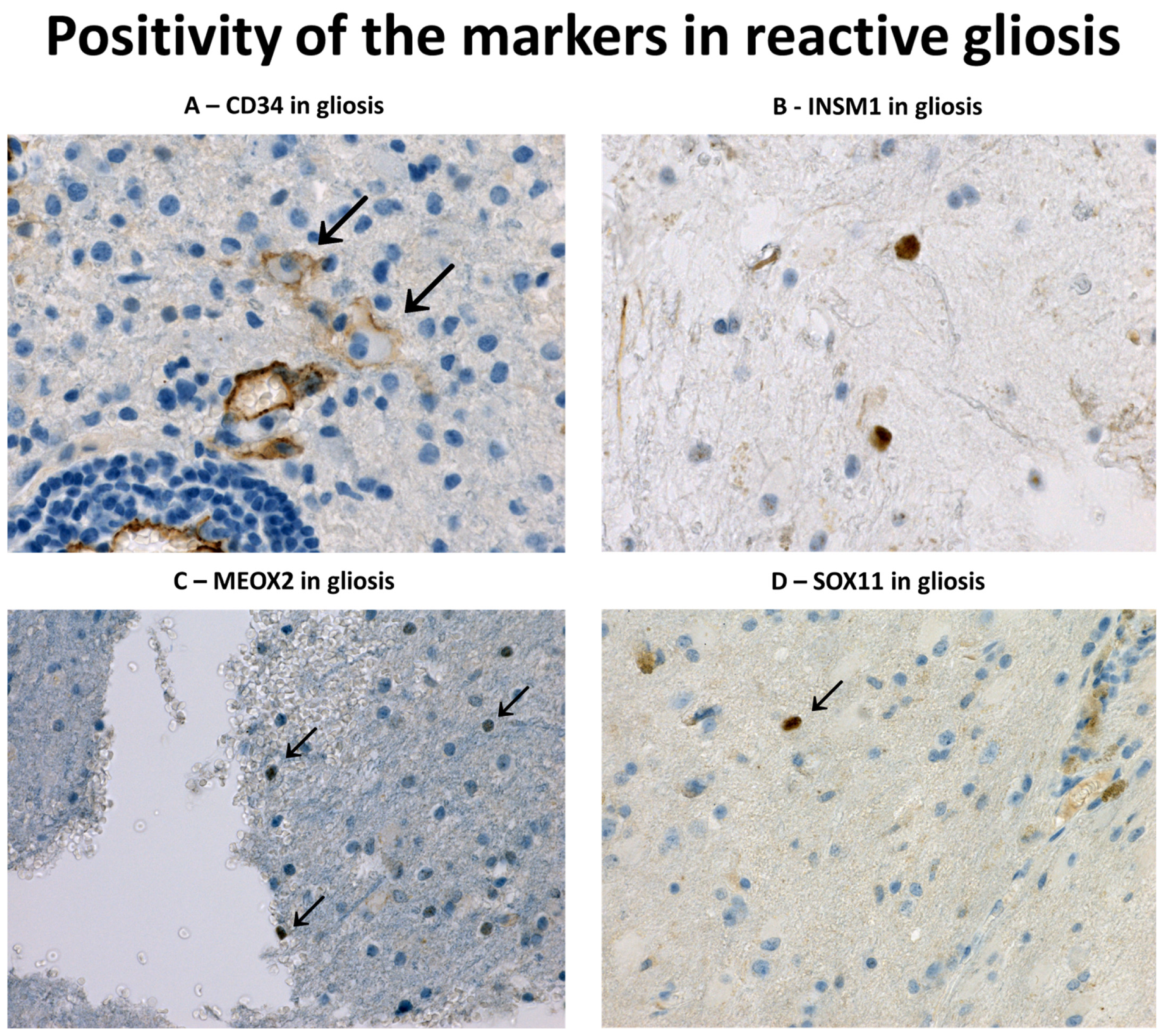 健康・医学 Diagnostic Immunohistochemistry Diagnostic Immunohistochemistry: Theranostic and Genomic