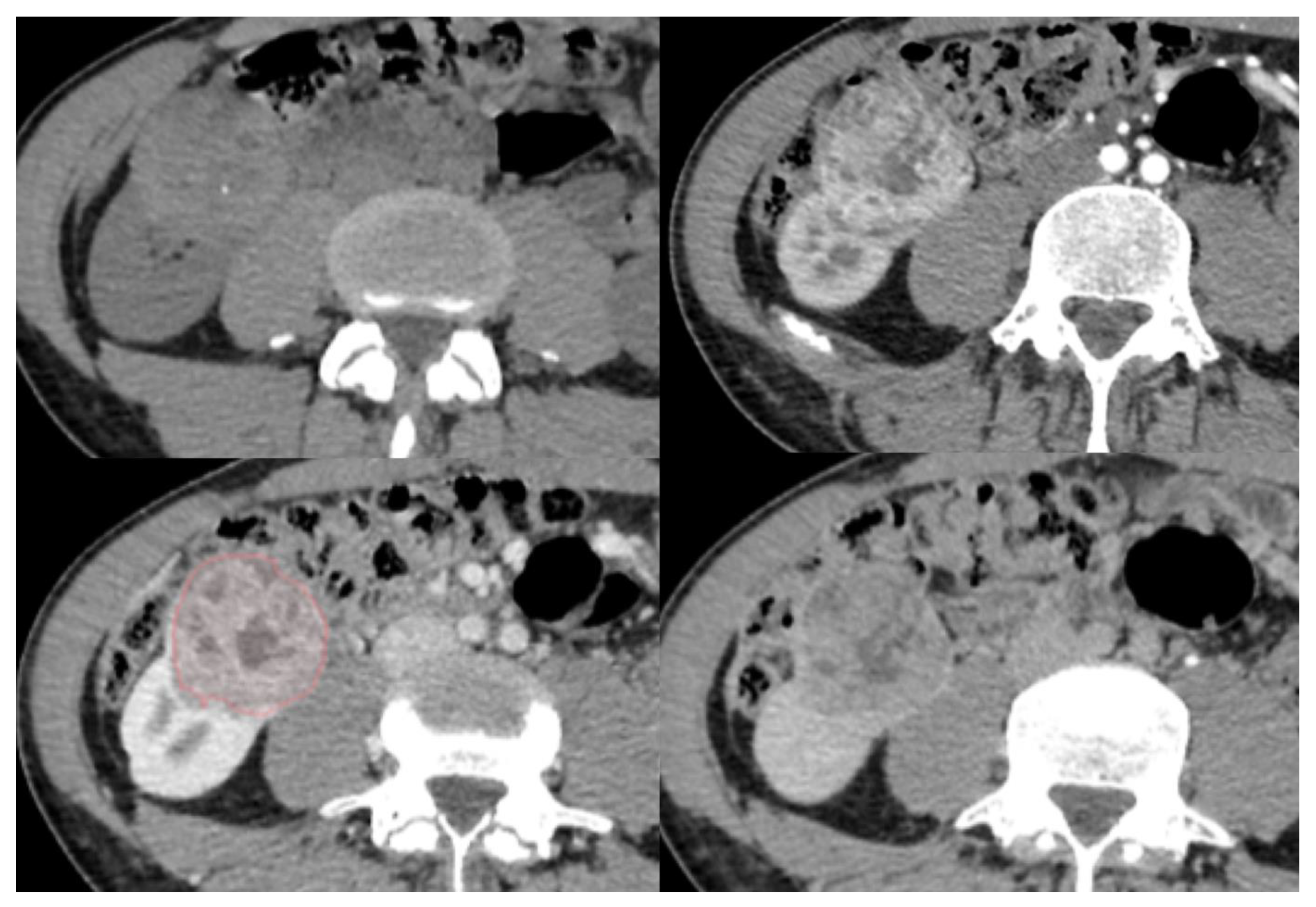 Diagnostics 13 02548 g002