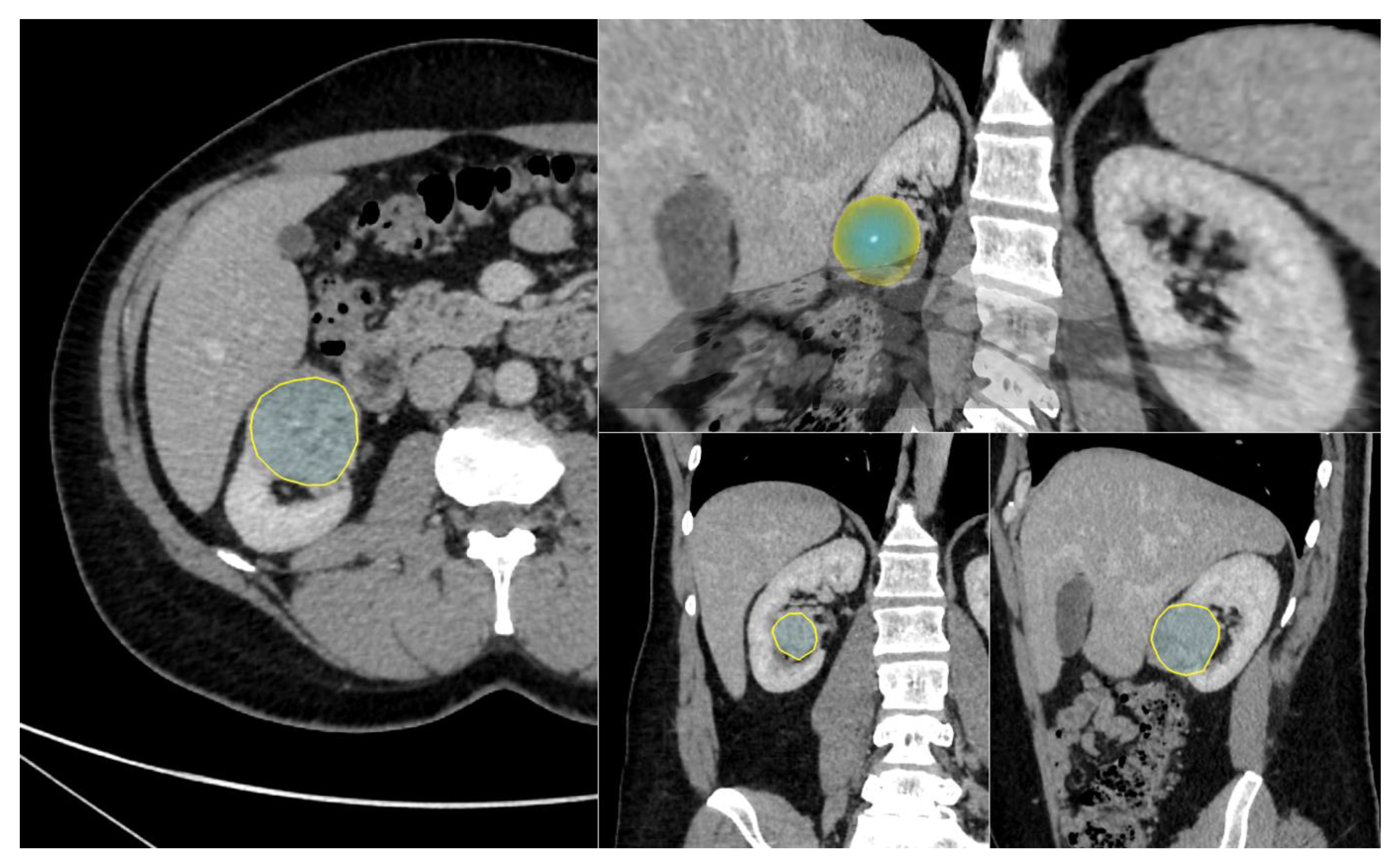 Diagnostics 13 02548 g003