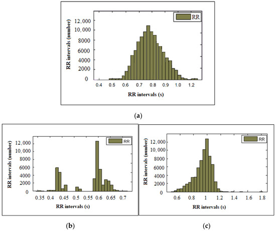 Heart Rate Variability Analysis of Healthy Individuals and Patients ...