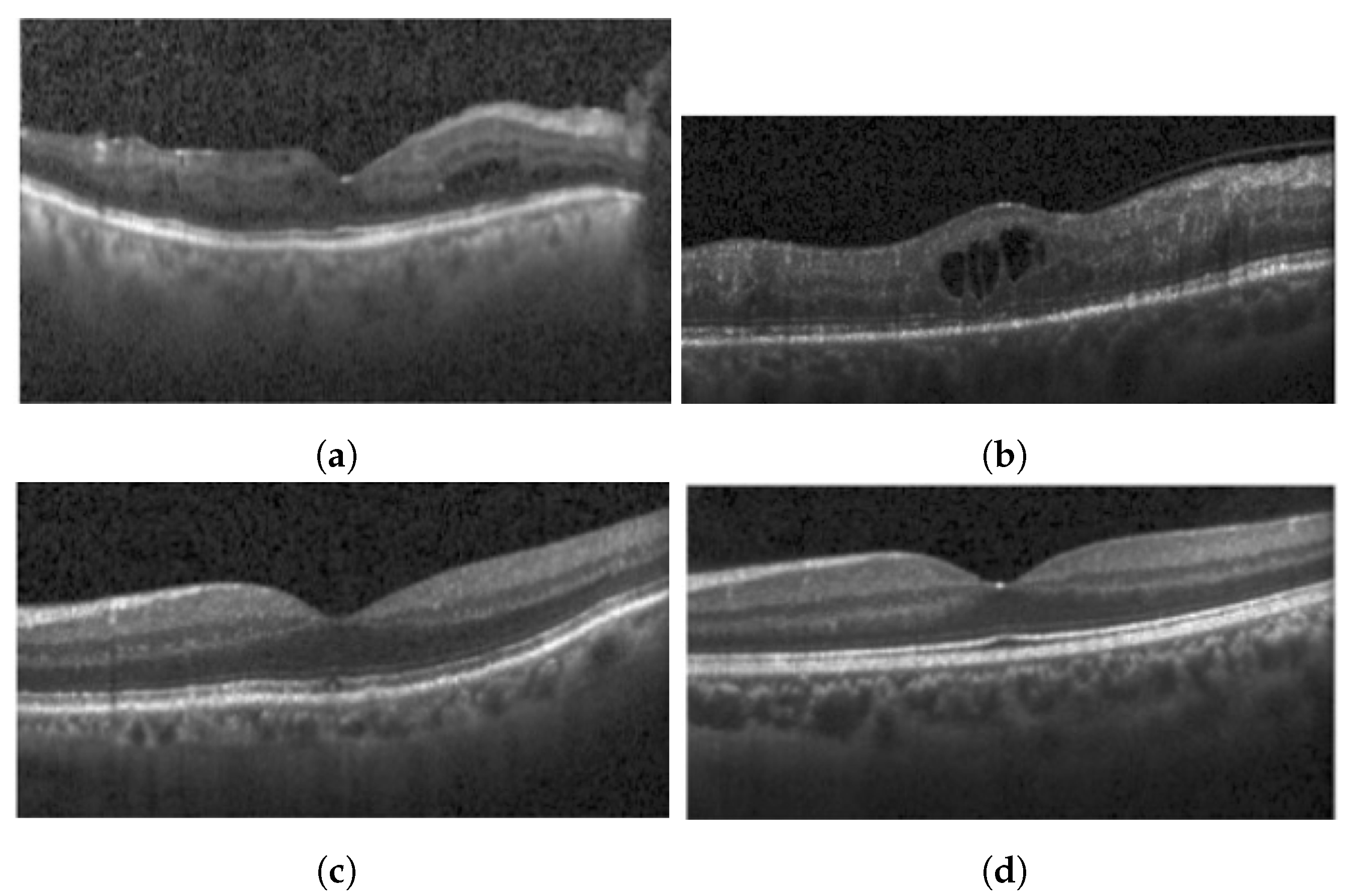 Diagnostics 13 02550 g003