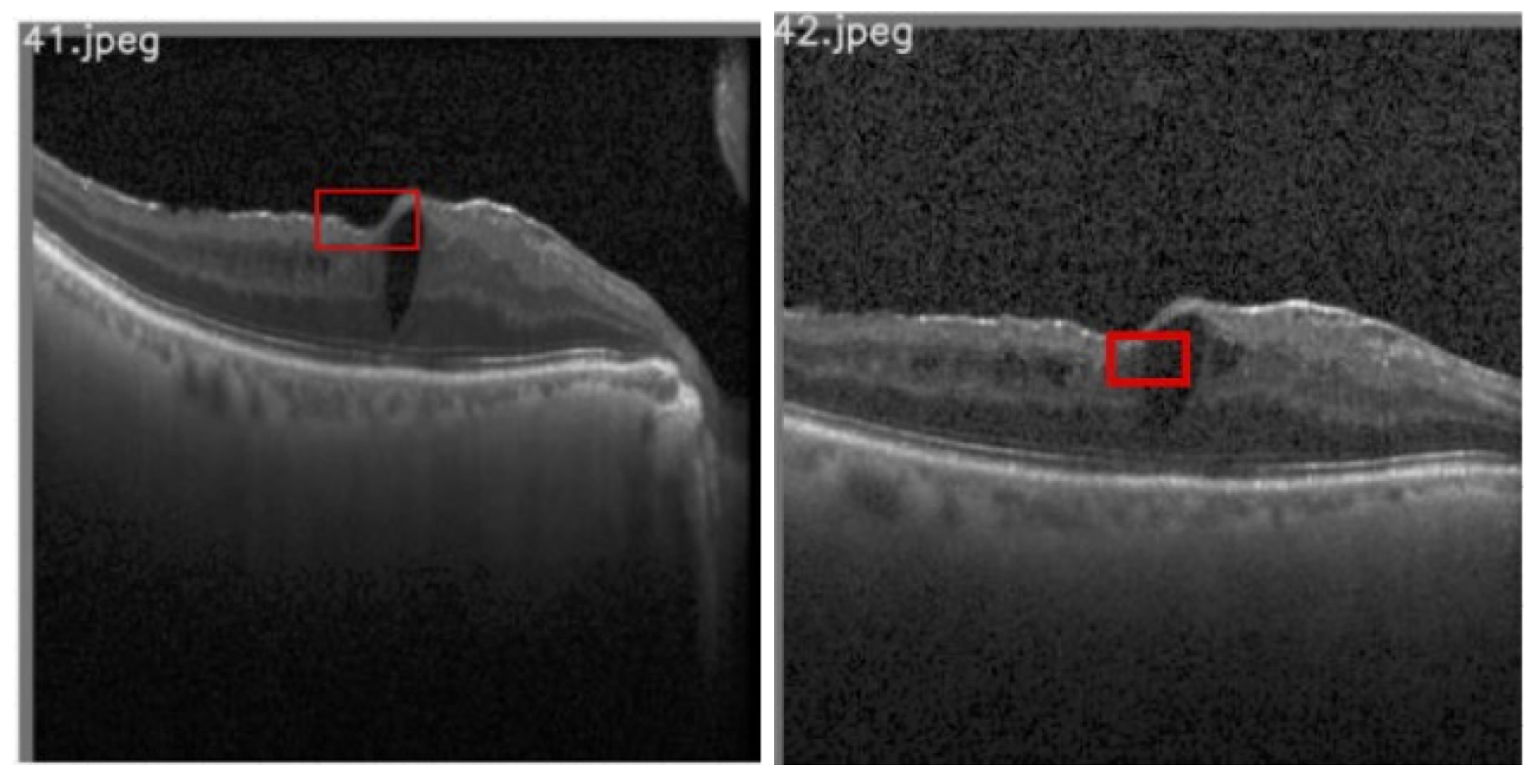 Diagnostics 13 02550 g014