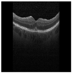 Diagnostics 13 02550 i013