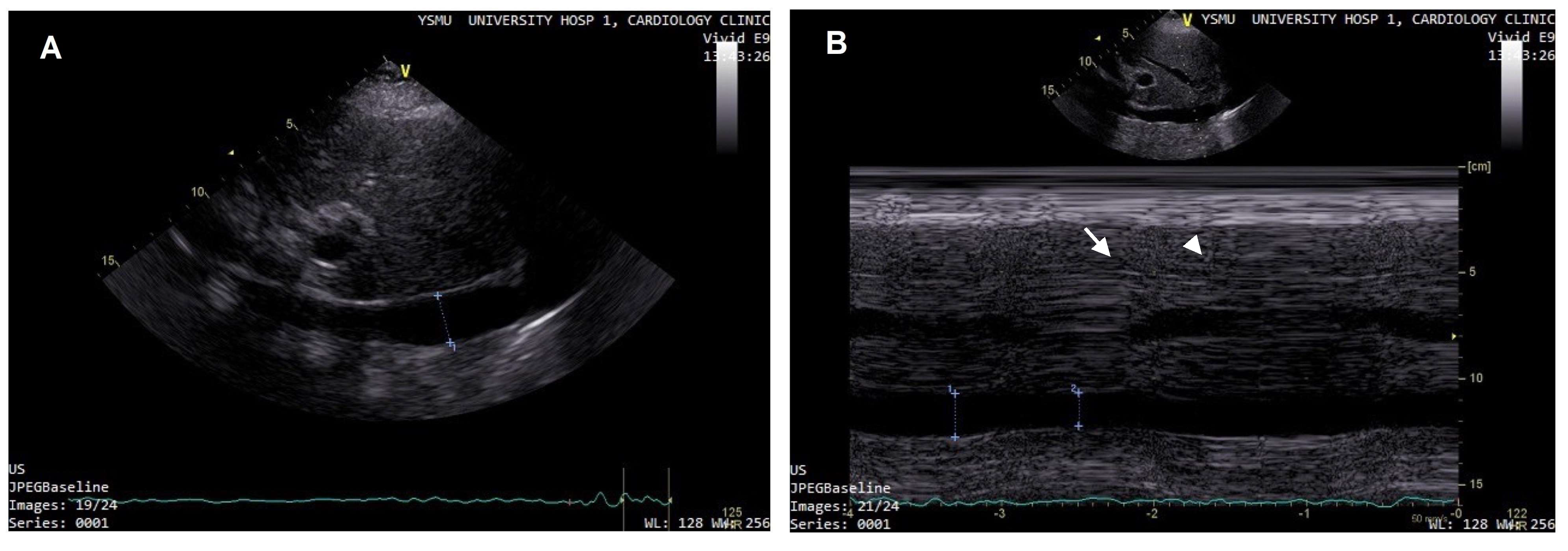 Diagnostics 13 02553 g003 Diagnostics 13 02553 g003