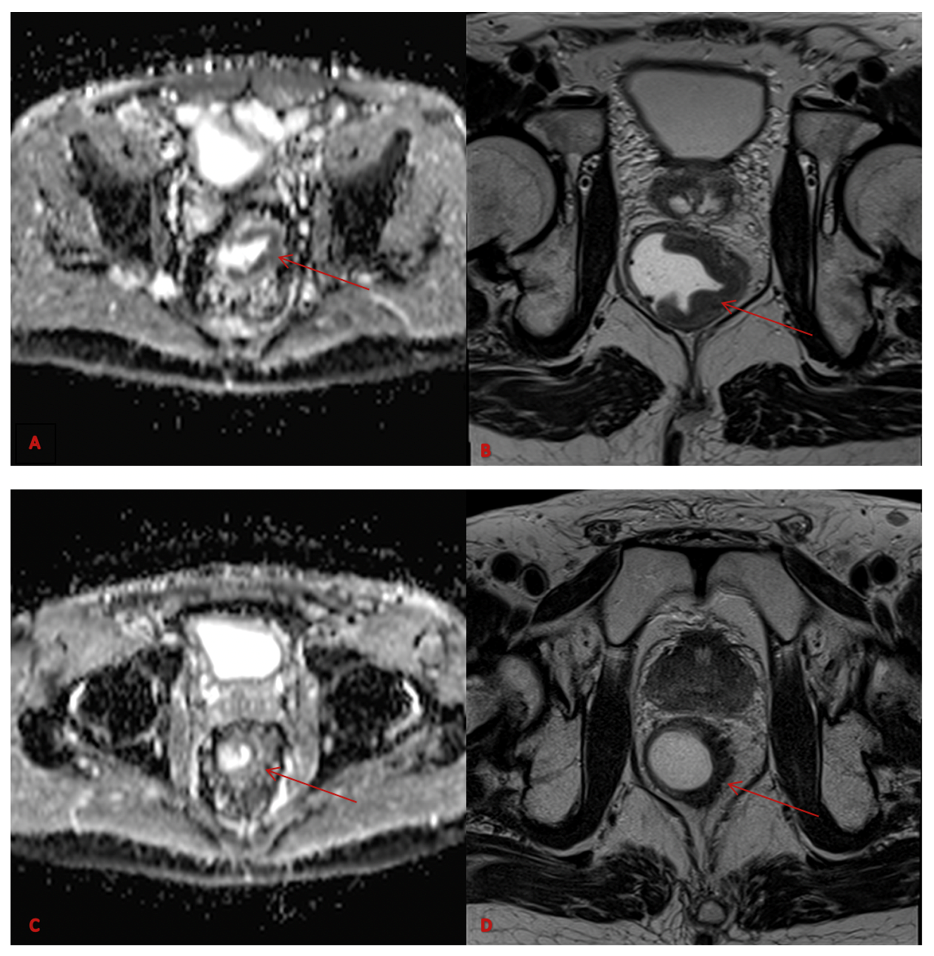 Diagnostics 13 02573 g001 Diagnostics 13 02573 g001