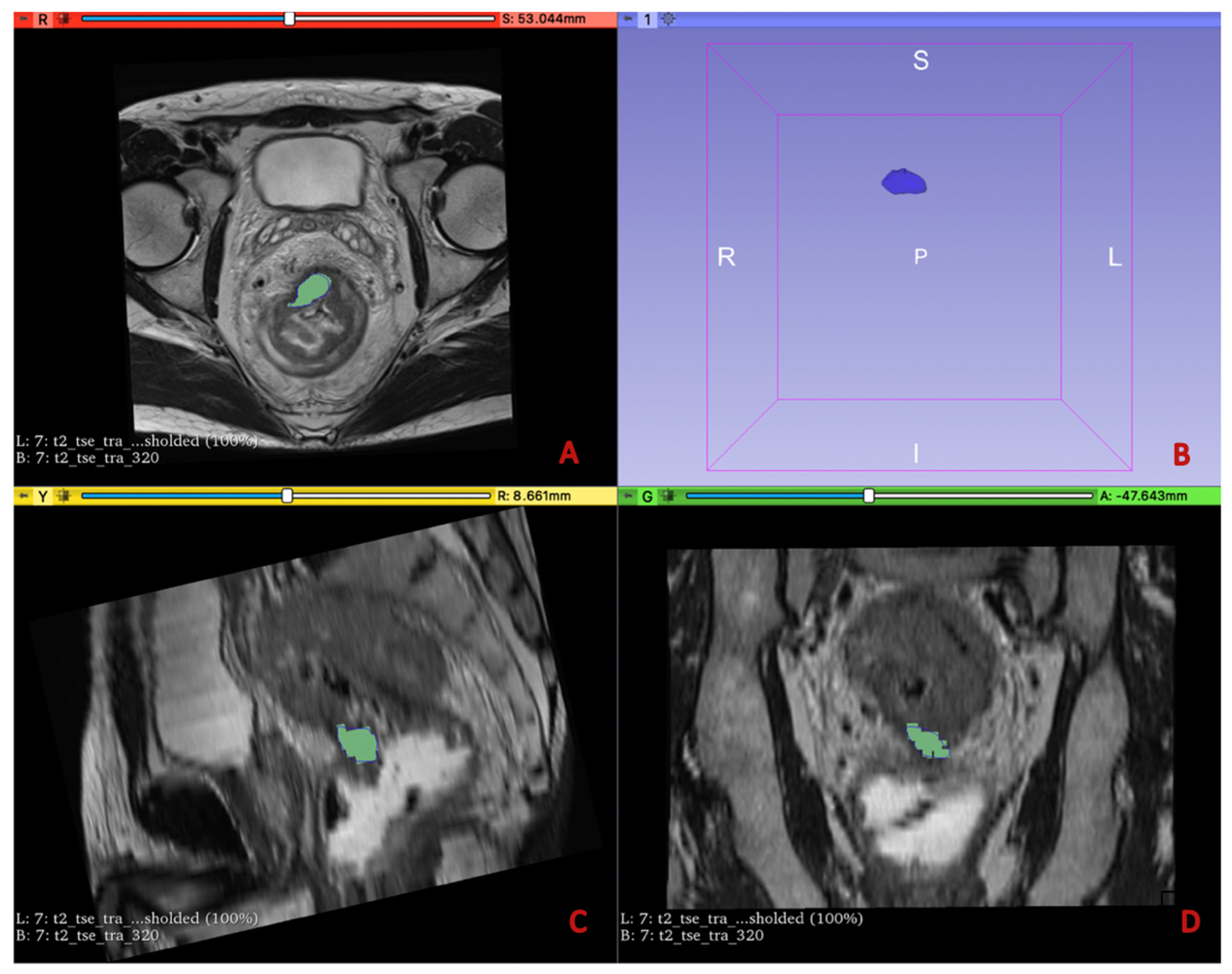 Diagnostics 13 02573 g002 Diagnostics 13 02573 g002