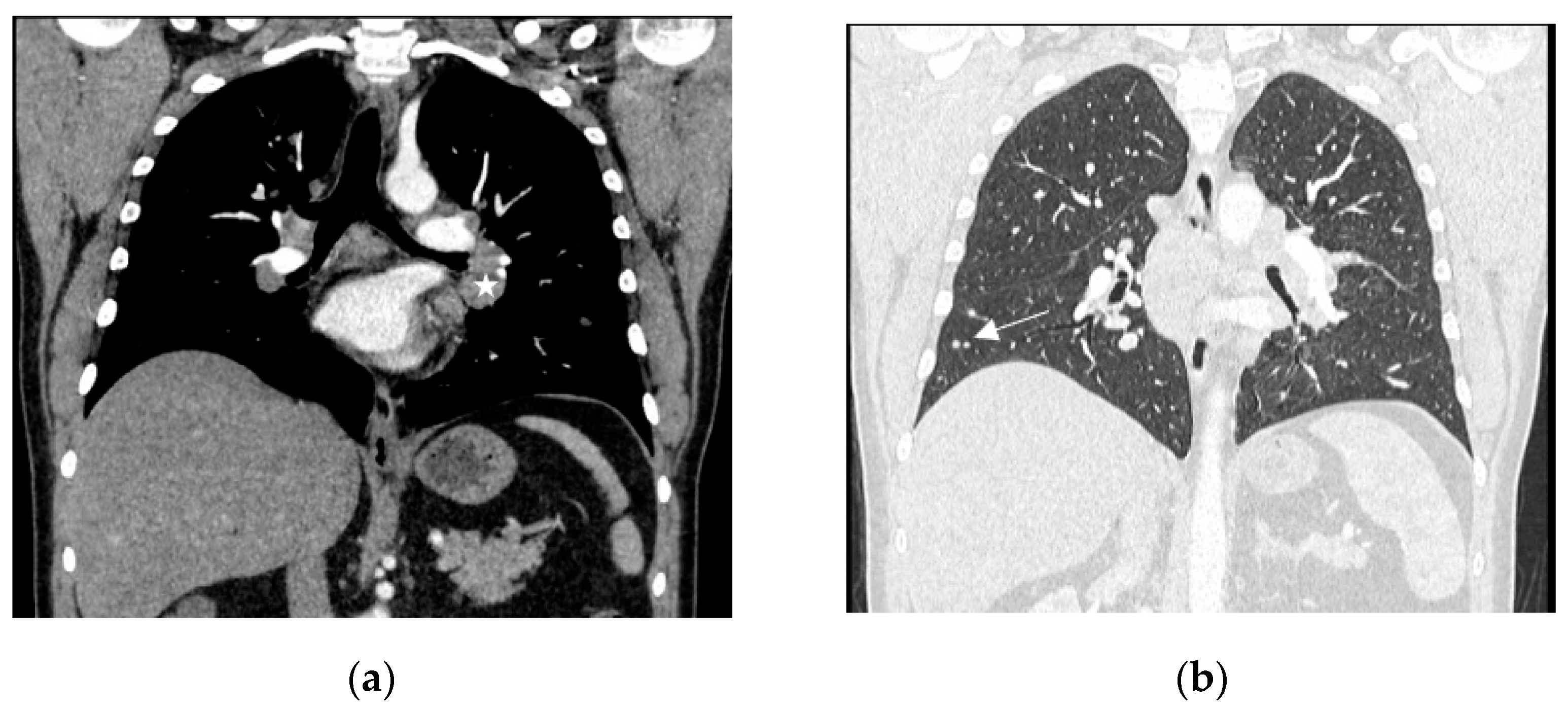 Diagnostics 13 02579 g002