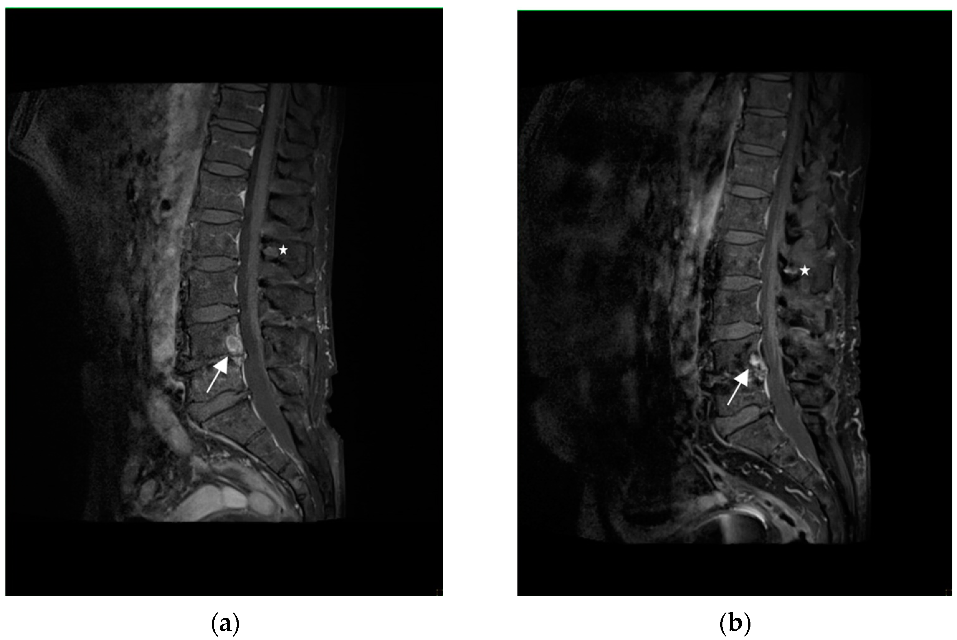 Diagnostics 13 02579 g003