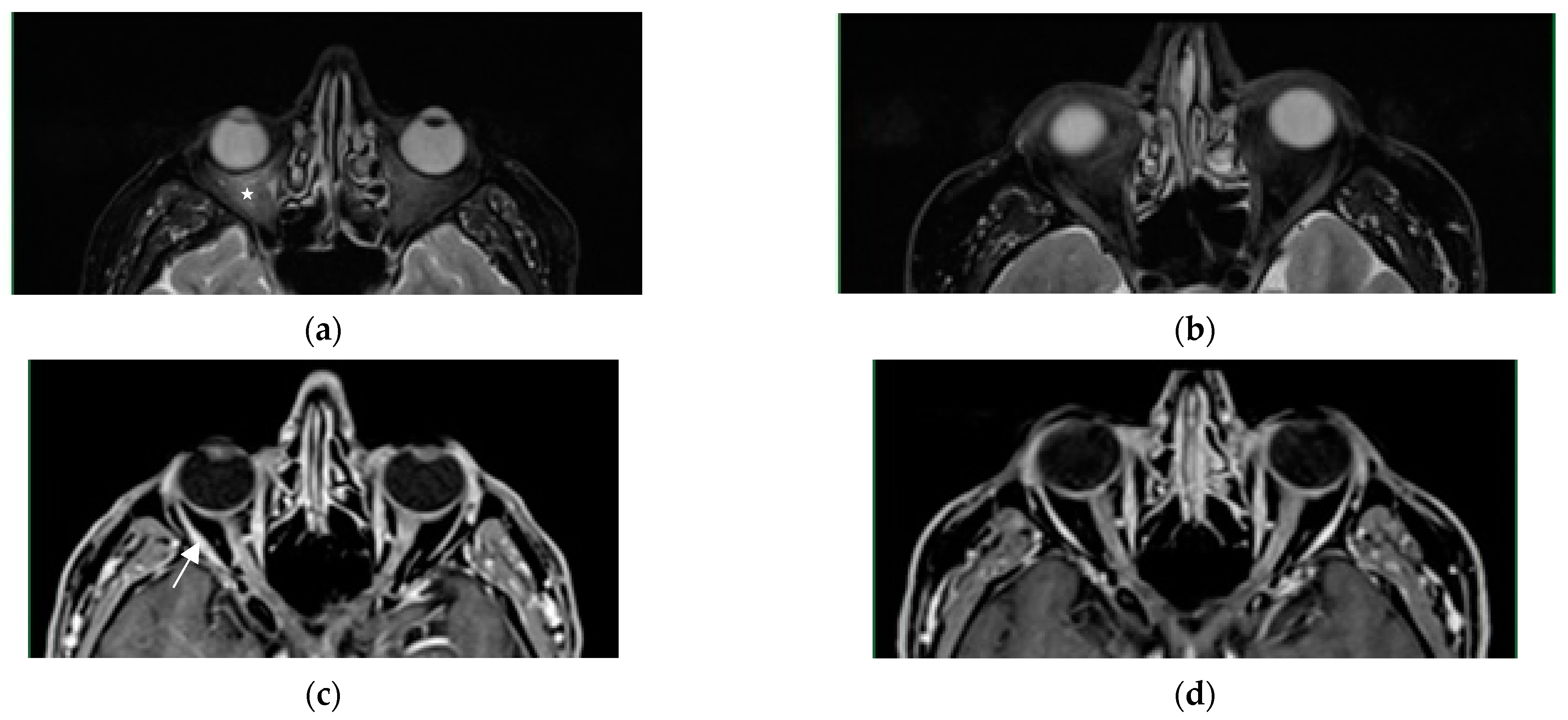 Diagnostics 13 02579 g004