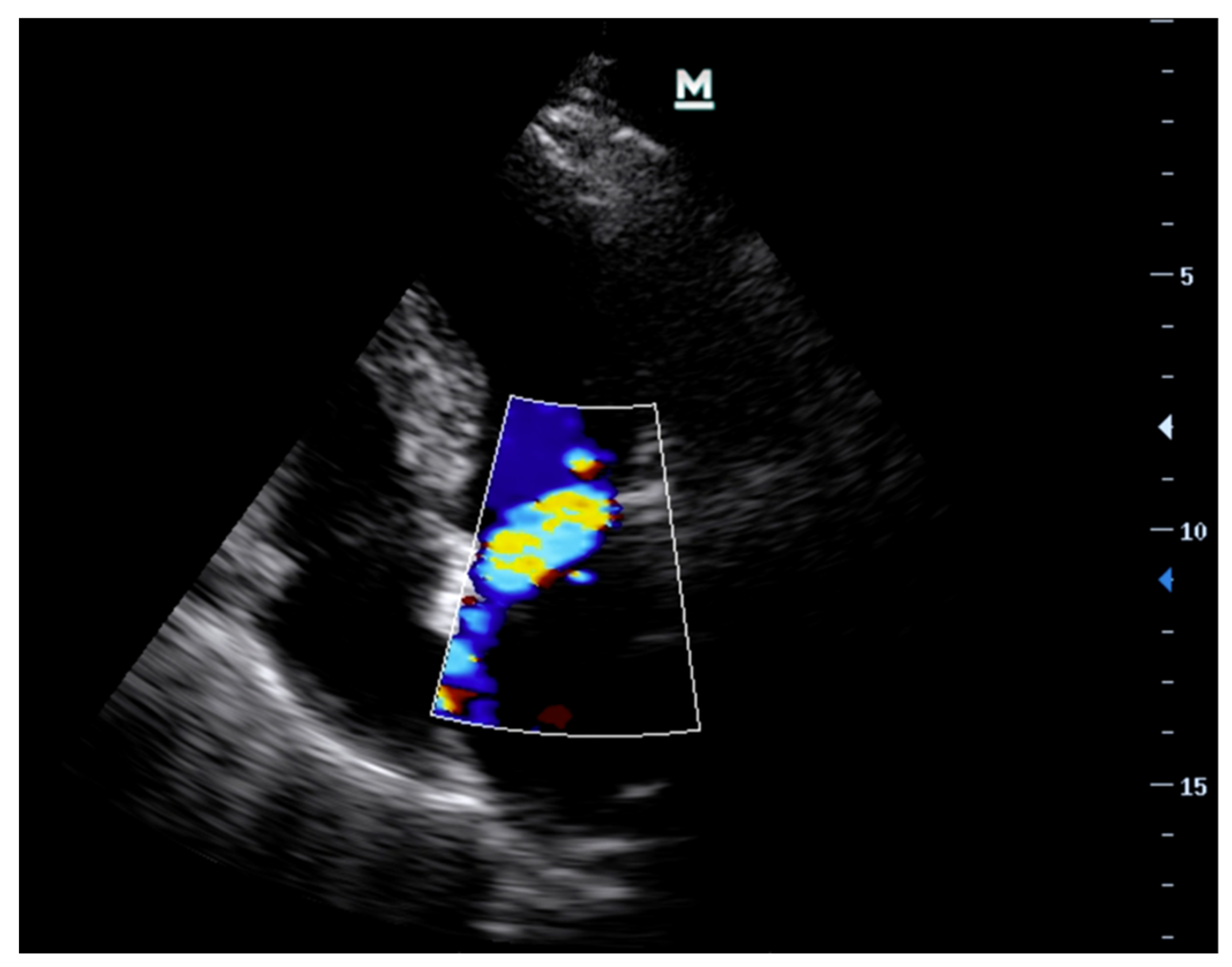 Diagnostics 13 02581 g004