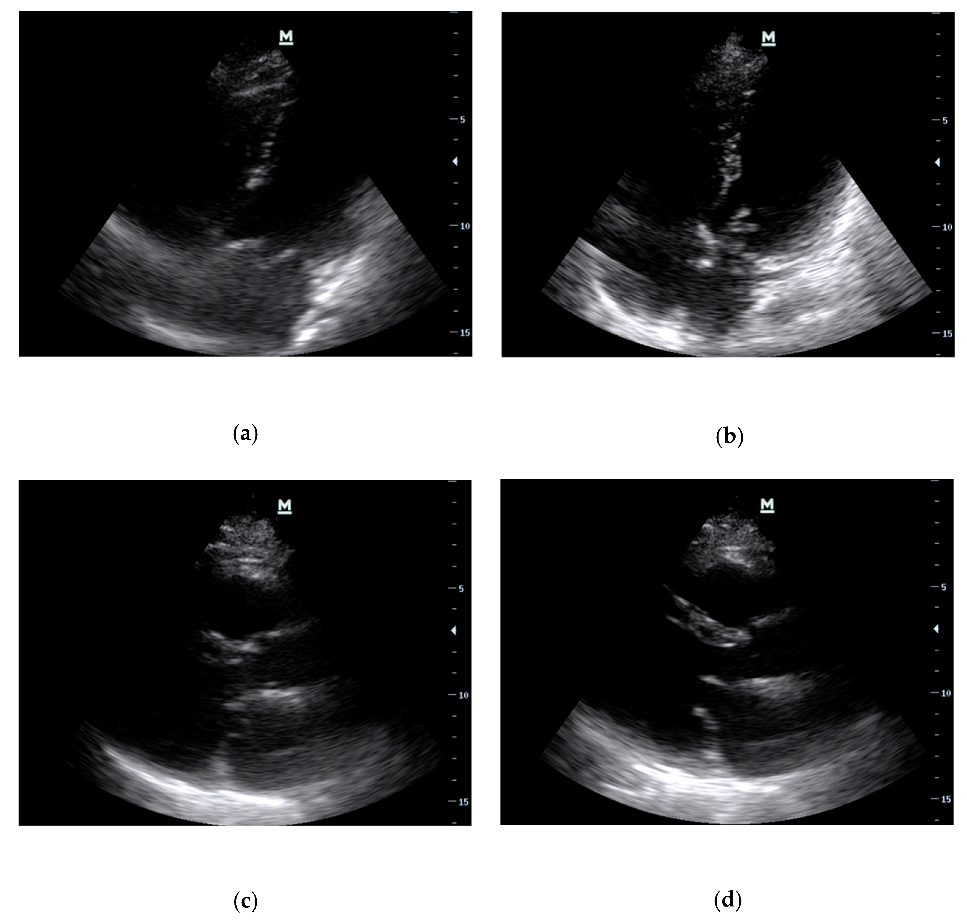 Diagnostics 13 02581 g005