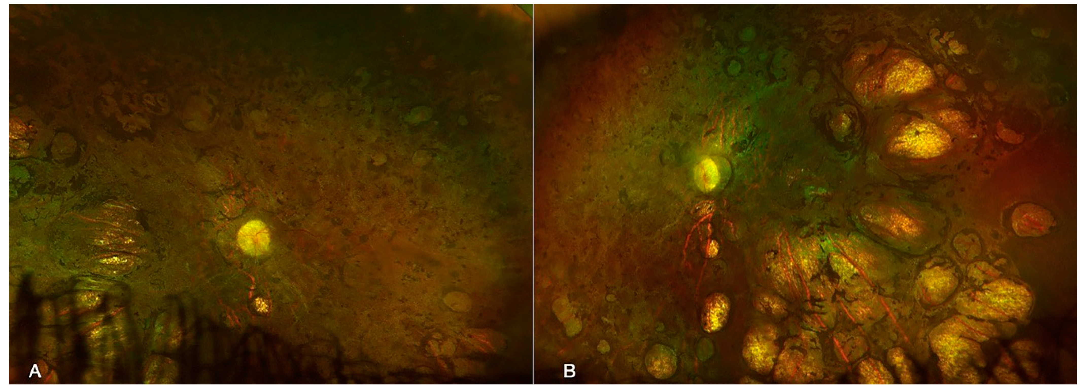Diagnostics 13 02588 g002 Diagnostics 13 02588 g002