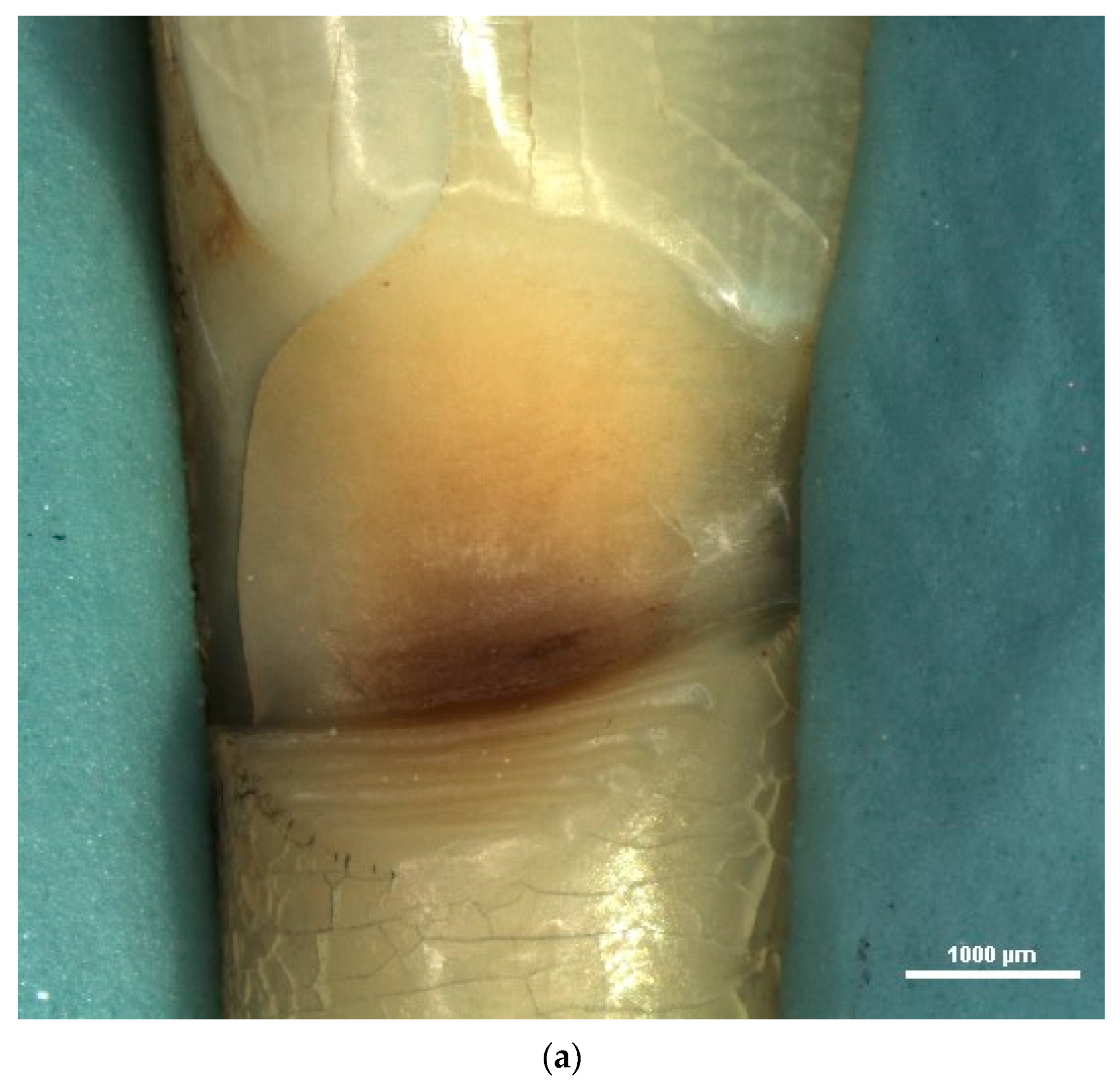 Diagnostics 13 02590 g005a Diagnostics 13 02590 g005a