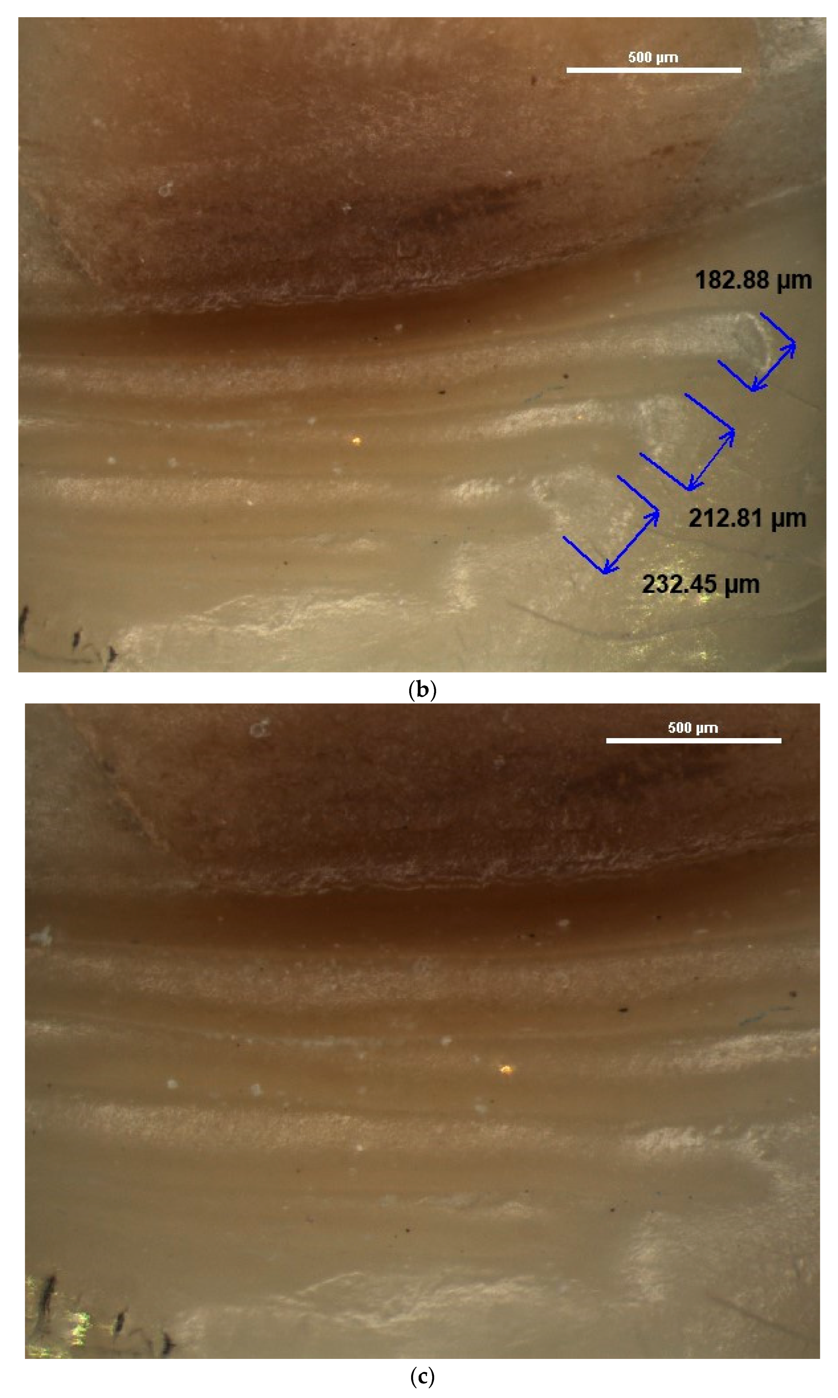 Diagnostics 13 02590 g005b Diagnostics 13 02590 g005b
