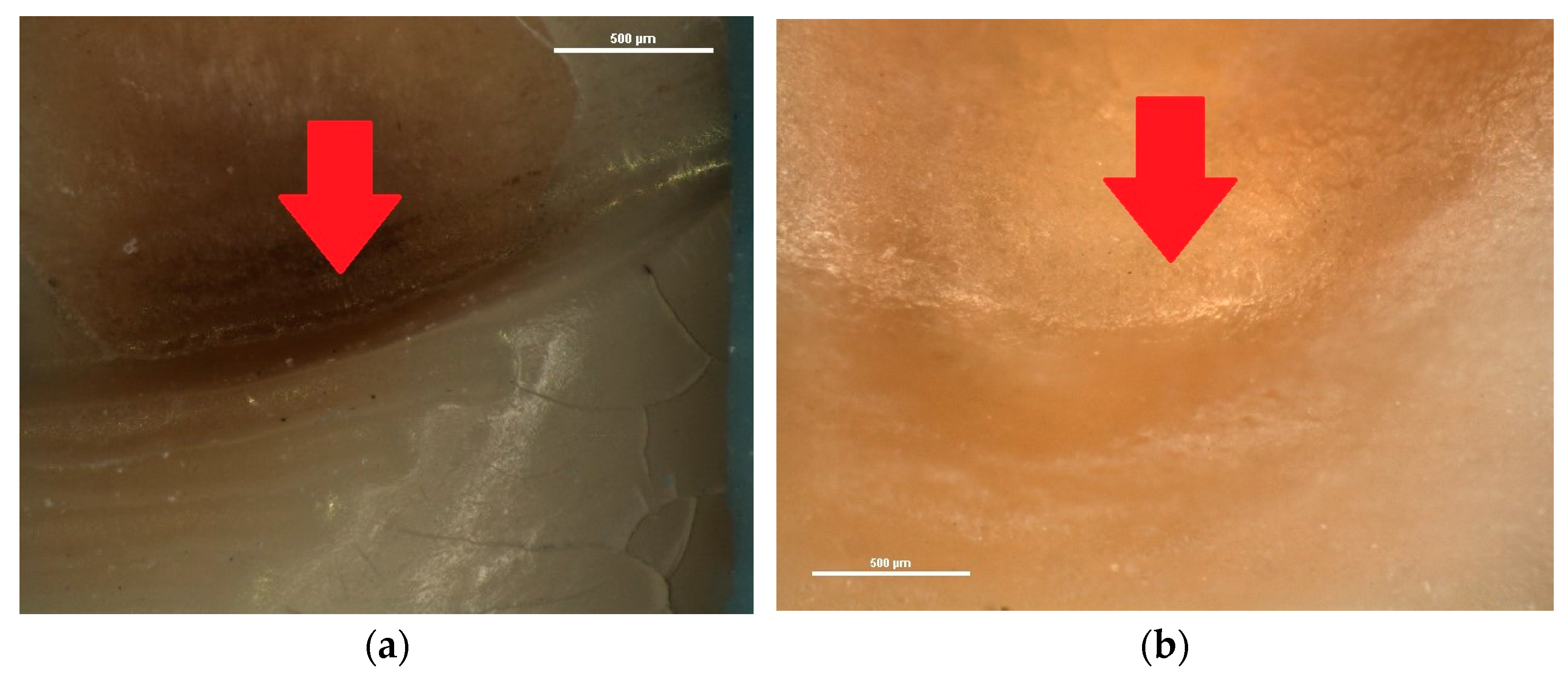 Diagnostics 13 02590 g006 Diagnostics 13 02590 g006