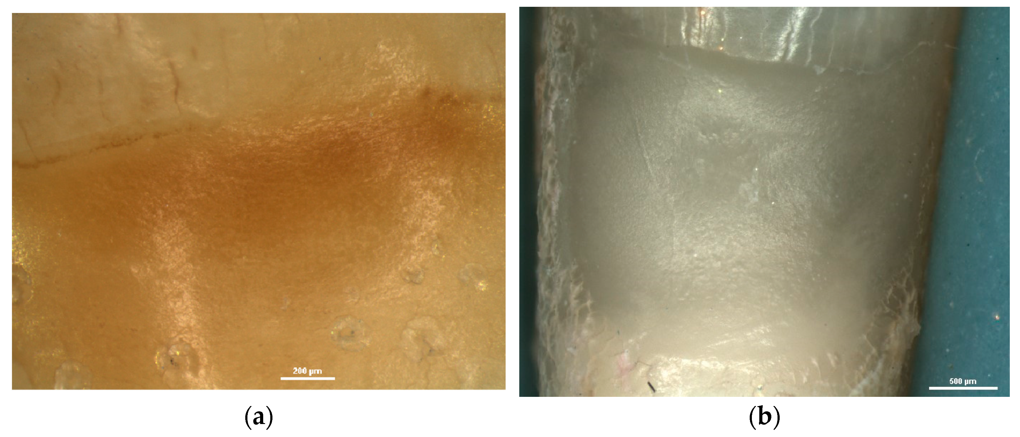 Diagnostics 13 02590 g007 Diagnostics 13 02590 g007