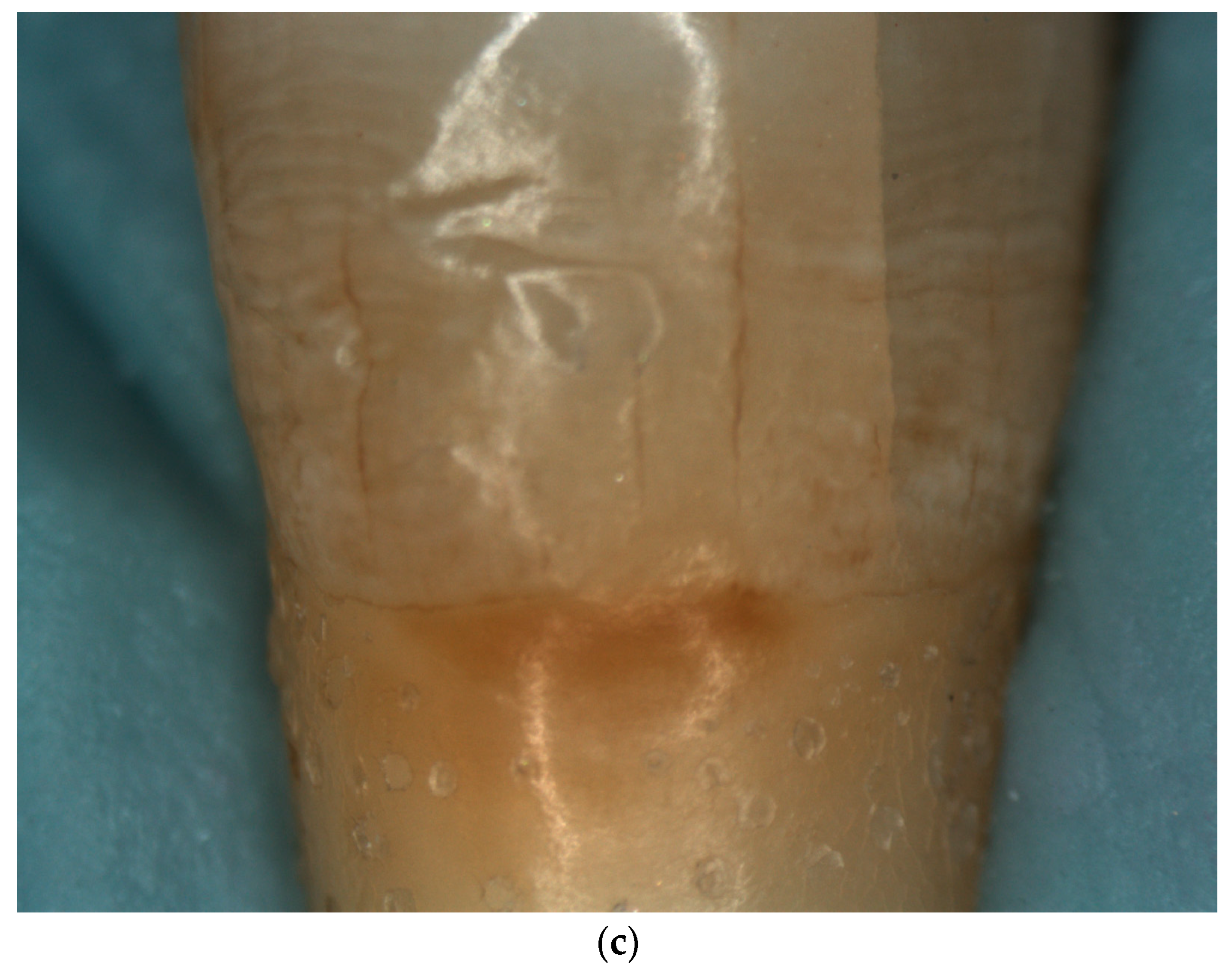 Diagnostics 13 02590 g008b Diagnostics 13 02590 g008b