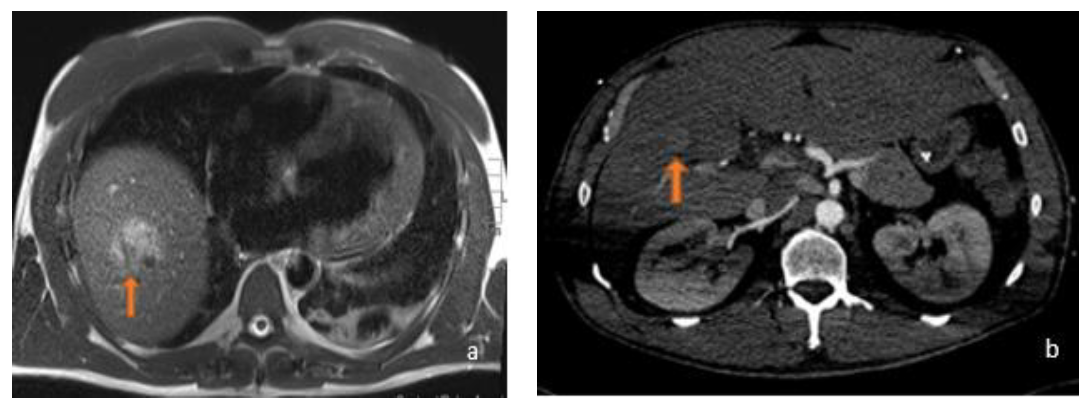 Diagnostics 13 02591 g002 Diagnostics 13 02591 g002
