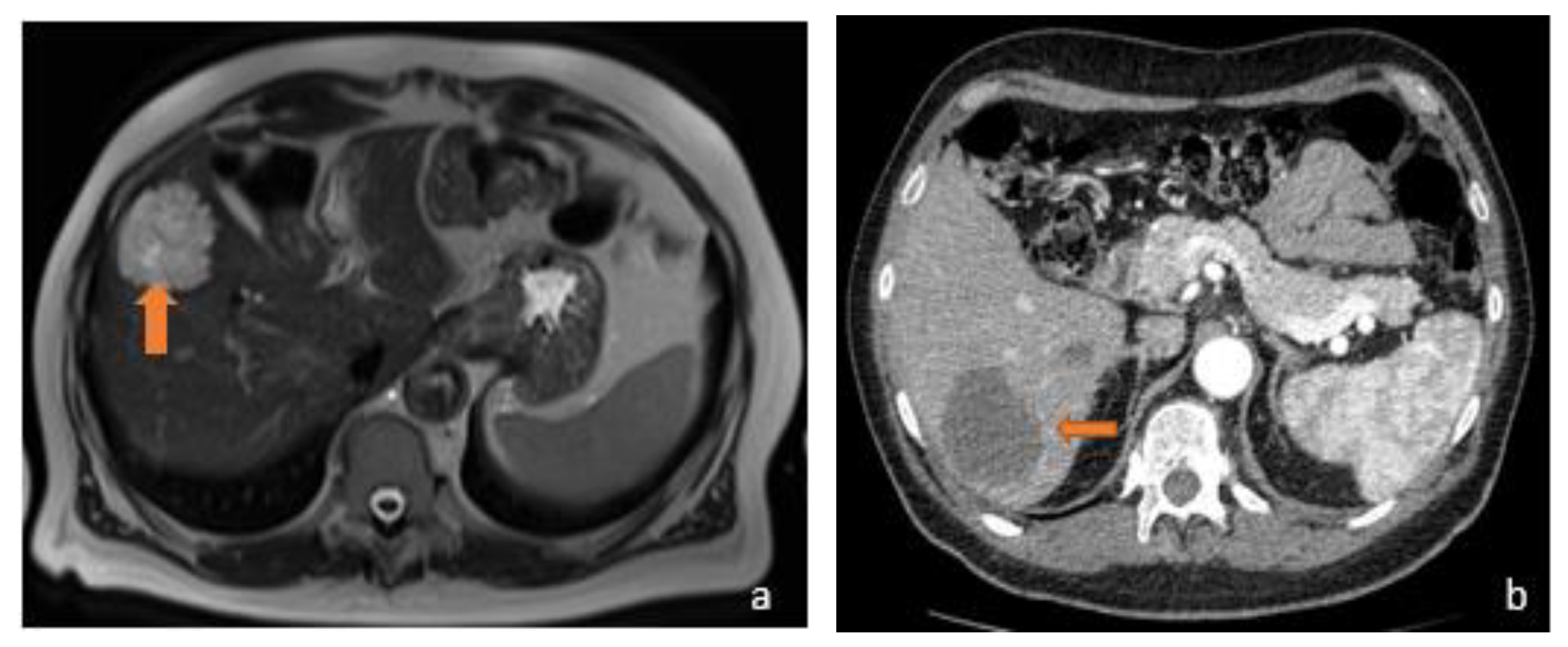 Diagnostics 13 02591 g003 Diagnostics 13 02591 g003
