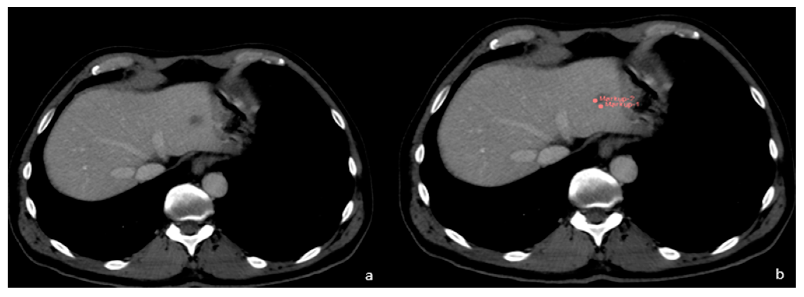 Diagnostics 13 02591 g004 Diagnostics 13 02591 g004