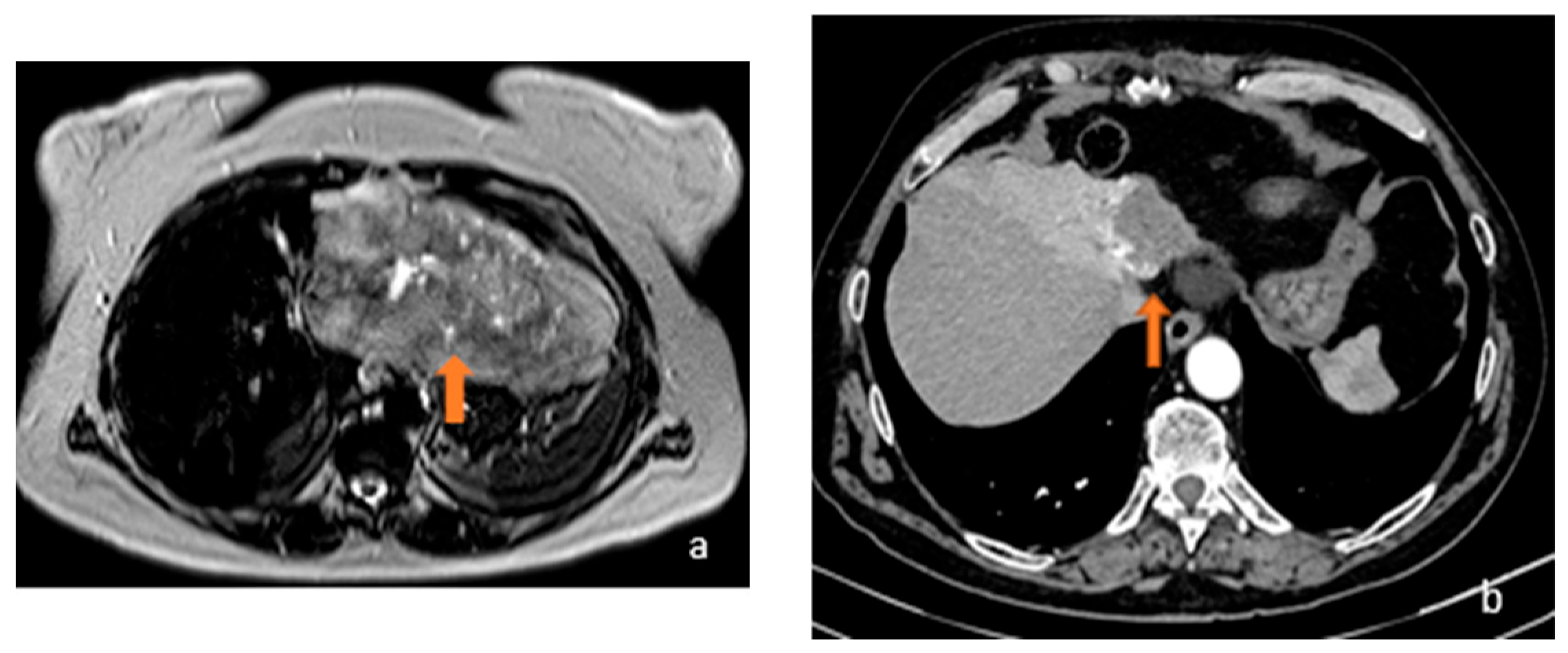 Diagnostics 13 02591 g005 Diagnostics 13 02591 g005