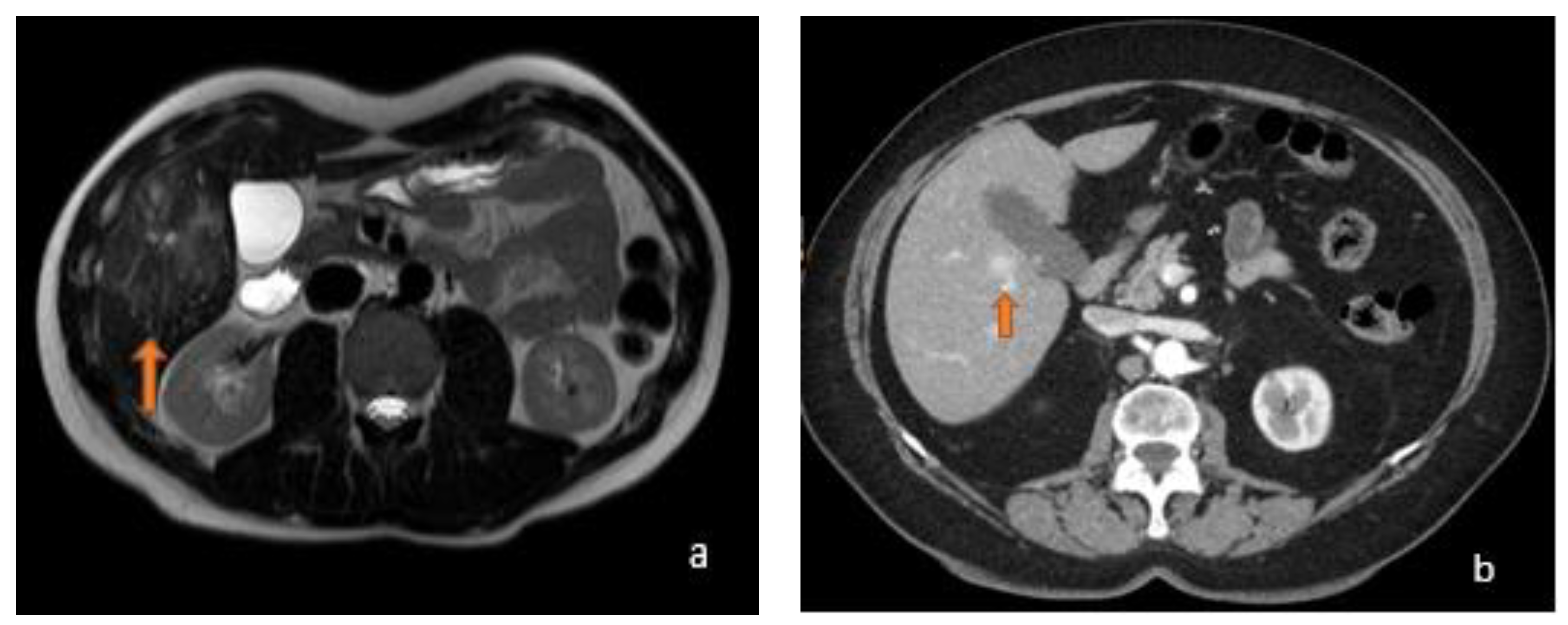 Diagnostics 13 02591 g006 Diagnostics 13 02591 g006