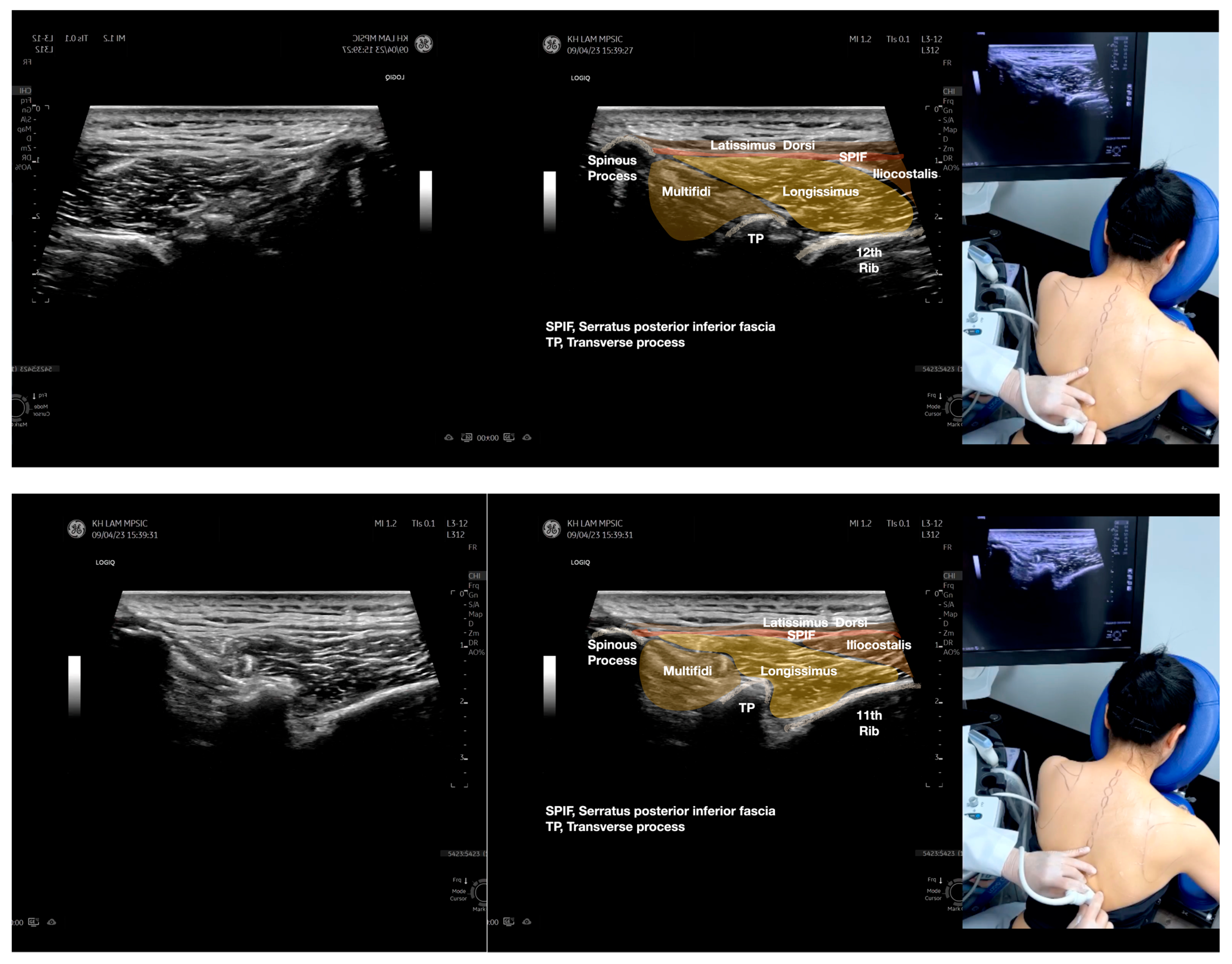 Diagnostics 13 02601 g002a Diagnostics 13 02601 g002a