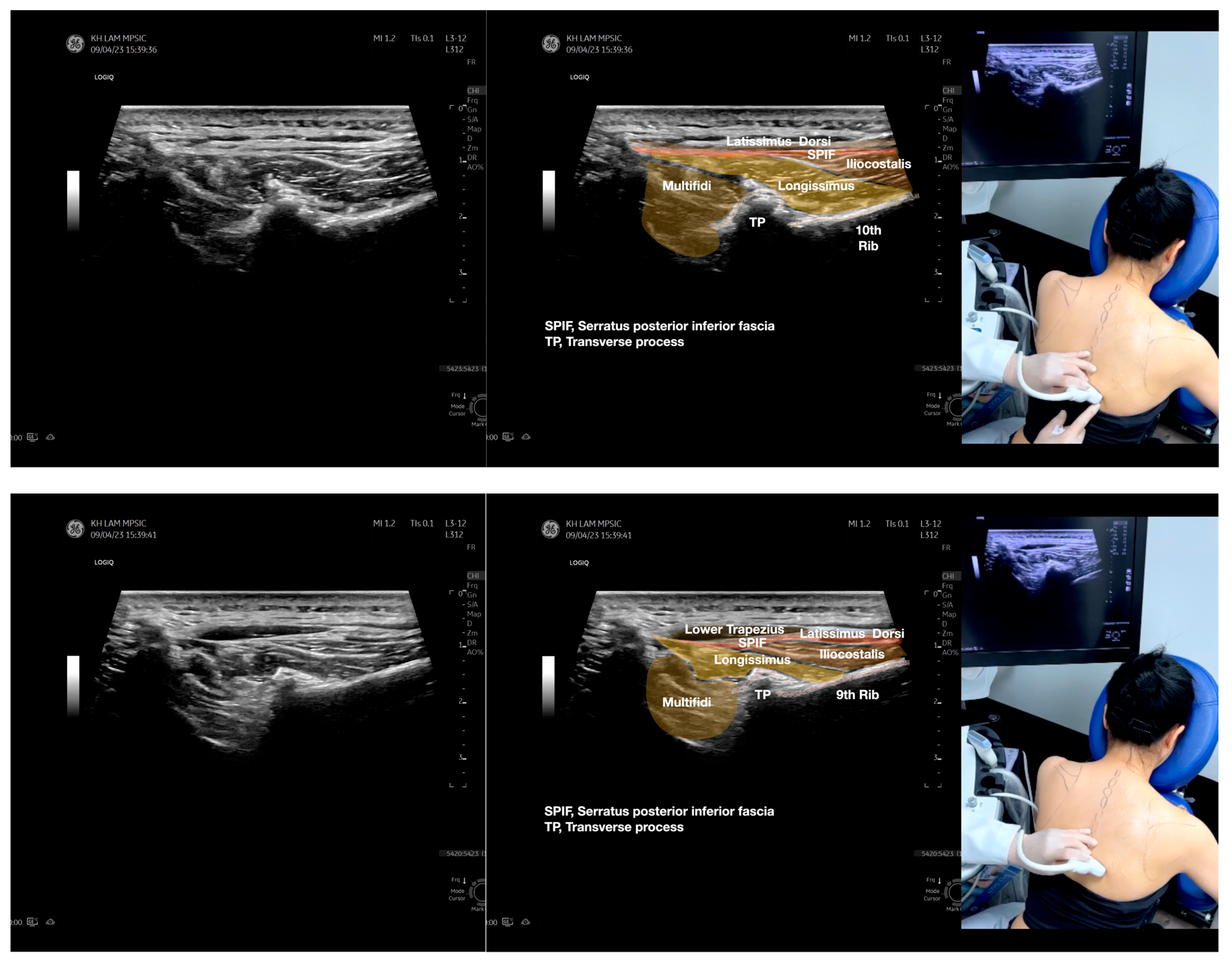 Diagnostics 13 02601 g002b Diagnostics 13 02601 g002b